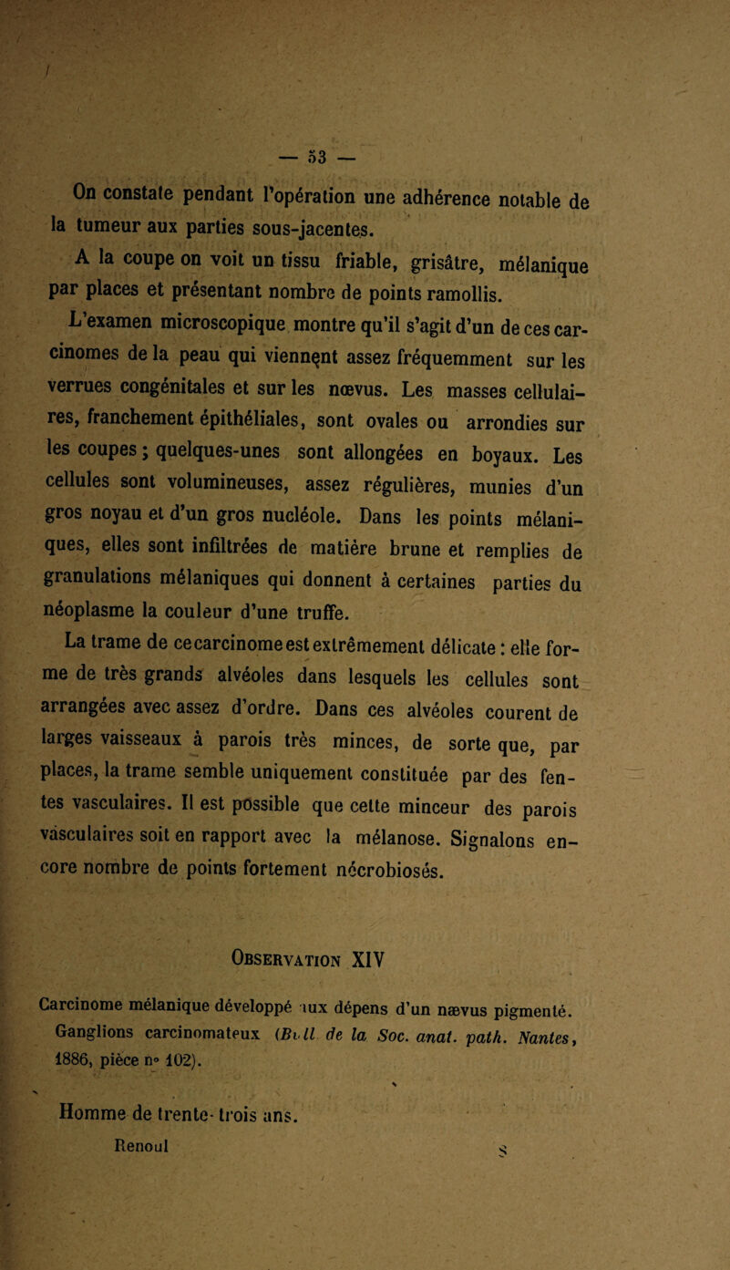 / — 53 — On constate pendant l’opération une adhérence notable de la tumeur aux parties sous-jacentes. A la coupe on voit un tissu friable, grisâtre, mélanique par places et présentant nombre de points ramollis. L’examen microscopique montre qu’il s’agit d’un de ces car¬ cinomes de la peau qui viennent assez fréquemment sur les verrues congénitales et sur les nœvus. Les masses cellulai¬ res, franchement epithéliales, sont ovales ou arrondies sur les coupes ; quelques-unes sont allongées en boyaux. Les cellules sont volumineuses, assez régulières, munies d’un gros noyau et d’un gros nucléole. Dans les points mélani¬ ques, elles sont infiltrées de matière brune et remplies de granulations mélaniques qui donnent à certaines parties du néoplasme la couleur d’une truffe. La trame de ce carcinome est extrêmement délicate : elle for- me de très grands alvéoles dans lesquels les cellules sont arrangées avec assez d ordre. Dans ces alvéoles courent de larges vaisseaux a parois très minces, de sorte que, par places, la trame semble uniquement constituée par des fen¬ tes vasculaires. Il est possible que celte minceur des parois vasculaires soit en rapport avec la mélanose. Signalons en¬ core nombre de points fortement nécrobioses. Observation XIY Carcinome mélanique développé iux dépens d’un naevus pigmenté. Ganglions carcinomateux (Bi ll de la Soc. anal. yath. Nantes, 1886, pièce n» 102). \ . Homme de trente- trois ans. Renoul o