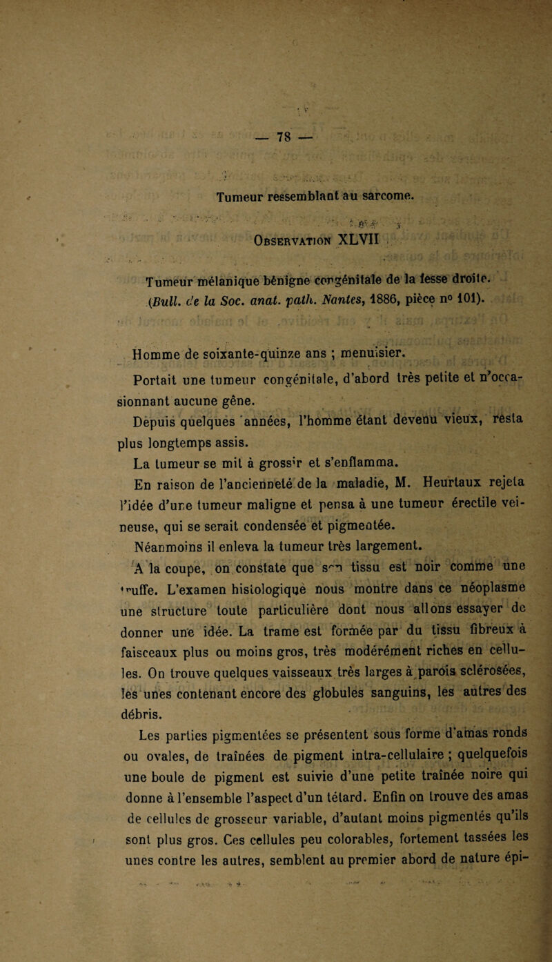 Tumeur ressemblant au sarcome. - • . • ■ y Observation XLVII Tumeur mélanique bénigne congénitale de la iesse droite. (Bull, de la Soc. anal. path. Nantes, 1886, pièce no 101). Homme de soixante-quinze ans ; menuisier. Portait une tumeur congénitale, d’abord très petite et ^occa¬ sionnant aucune gêne. Depuis quelques années, l’homme étant devenu vieux, resta plus longtemps assis. La tumeur se mil à grossir et s’enflamma. En raison de l’ancienneté de la maladie, M. Heurtaux rejeta l’idée d’une tumeur maligne et pensa à une tumeur érectile vei¬ neuse, qui se serait condensée et pigmentée. Néanmoins il enleva la tumeur très largement. A la coupe, on constate que s^n tissu est noir comme une ^uffe. L’examen histologique nous montre dans ce néoplasme une structure toute particulière dont nous allons essayer de donner une idée. La trame est formée par du tissu fibreux à faisceaux plus ou moins gros, très modérément riches en cellu¬ les. On trouve quelques vaisseaux très larges à parois sclérosées, les unes contenant encore des globules sanguins, les autres des débris. Les parties pigmentées se présentent sous forme d’amas ronds ou ovales, de traînées de pigment intra-cellulaire ; quelquefois une boule de pigment est suivie d’une petite traînée noire qui donne à l’ensemble l’aspect d’un têtard. Enfin on trouve des amas de cellules de grosseur variable, d’autant moins pigmentés qu’ils sont plus gros. Ces cellules peu colorables, fortement tassées les unes contre les autres, semblent au premier abord de nature épi-
