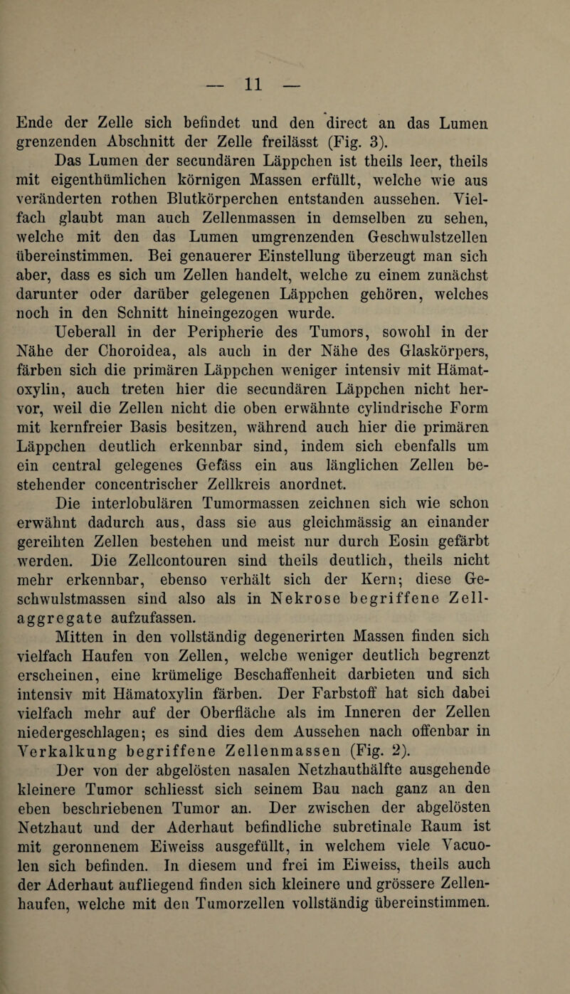 Ende der Zelle sich befindet und den direct an das Lumen grenzenden Abschnitt der Zelle freilässt (Fig. 3). Das Lumen der secundären Läppchen ist theils leer, theils mit eigentümlichen körnigen Massen erfüllt, welche wie aus veränderten rothen Blutkörperchen entstanden aussehen. Viel¬ fach glaubt man auch Zellenmassen in demselben zu sehen, welche mit den das Lumen umgrenzenden Geschwulstzellen ühereinstimmen. Bei genauerer Einstellung überzeugt man sich aber, dass es sich um Zellen handelt, welche zu einem zunächst darunter oder darüber gelegenen Läppchen gehören, welches noch in den Schnitt hineingezogen wurde. Ueberall in der Peripherie des Tumors, sowohl in der Nähe der Choroidea, als auch in der Nähe des Glaskörpers, färben sich die primären Läppchen weniger intensiv mit Hämat- oxylin, auch treten hier die secundären Läppchen nicht her¬ vor, weil die Zellen nicht die oben erwähnte cylindrische Form mit kernfreier Basis besitzen, während auch hier die primären Läppchen deutlich erkennbar sind, indem sich ebenfalls um ein central gelegenes Gefäss ein aus länglichen Zellen be¬ stehender concentrischer Zellkreis anordnet. Die interlobulären Tumormassen zeichnen sich wie schon erwähnt dadurch aus, dass sie aus gleichmässig an einander gereihten Zellen bestehen und meist nur durch Eosin gefärbt werden. Die Zellcontouren sind theils deutlich, theils nicht mehr erkennbar, ebenso verhält sich der Kern; diese Ge¬ schwulstmassen sind also als in Nekrose begriffene Zell¬ aggregate aufzufassen. Mitten in den vollständig degenerirten Massen finden sich vielfach Haufen von Zellen, welche weniger deutlich begrenzt erscheinen, eine krümelige Beschaffenheit darbieten und sich intensiv mit Hämatoxylin färben. Der Farbstoff hat sich dabei vielfach mehr auf der Oberfläche als im Inneren der Zellen niedergeschlagen; es sind dies dem Aussehen nach offenbar in Verkalkung begriffene Zellenmassen (Fig. 2). Der von der abgelösten nasalen Netzhauthälfte ausgehende kleinere Tumor schliesst sich seinem Bau nach ganz an den eben beschriebenen Tumor an. Der zwischen der abgelösten Netzhaut und der Aderhaut befindliche subretinale Baum ist mit geronnenem Eiweiss ausgefüllt, in welchem viele Vacuo- len sich befinden. In diesem und frei im Eiweiss, theils auch der Aderhaut aufliegend finden sich kleinere und grössere Zellen¬ haufen, welche mit deu Tumorzellen vollständig übereinstimmen.