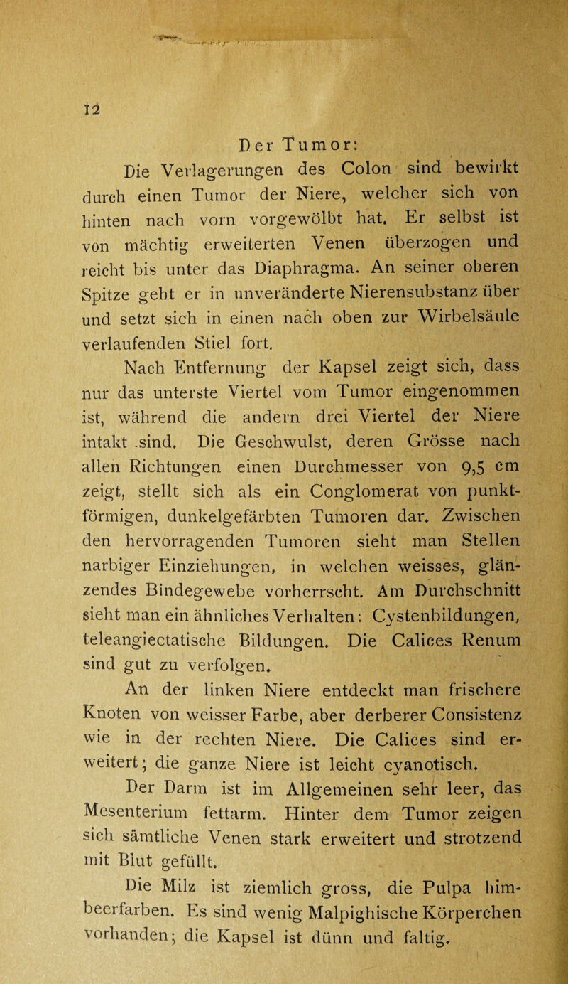 Der Tumor: Die Verlagerungen des Colon sind bewirkt durch einen Tumor der Niere, welcher sich von hinten nach vorn vorgewölbt hat. Er selbst ist von mächtig erweiterten Venen überzogen und reicht bis unter das Diaphragma. An seiner oberen Spitze geht er in unveränderte Nierensubstanz über und setzt sich in einen nach oben zur Wirbelsäule verlaufenden Stiel fort. Nach Entfernung der Kapsel zeigt sich, dass nur das unterste Viertel vom Tumor eingenommen ist, während die andern drei Viertel der Niere intakt .sind. Die Geschwulst, deren Grösse nach allen Richtungen einen Durchmesser von 9,5 cm zeigt, stellt sich als ein Conglomerat von punkt¬ förmigen, dunkelgefärbten Tumoren dar» Zwischen den hervorragenden Tumoren sieht man Stellen narbiger Einziehungen, in welchen weisses, glän¬ zendes Bindegewebe vorherrscht. Am Durchschnitt sieht man ein ähnliches Verhalten: Cystenbildungen, teleangiectatische Bildungen. Die Calices Renum sind gut zu verfolgen. An der linken Niere entdeckt man frischere Knoten von weisser Farbe, aber derberer Consistenz wie in der rechten Niere. Die Calices sind er¬ weitert; die ganze Niere ist leicht cyanotisch. Der Darm ist im Allgemeinen sehr leer, das Mesenterium fettarm. Hinter dem Tumor zeigen sich sämtliche Venen stark erweitert und strotzend mit Blut gefüllt. Die Milz ist ziemlich gross, die Pulpa him¬ beerfarben. Es sind wenig Malpighische Körperchen vorhanden; die Kapsel ist dünn und faltig.