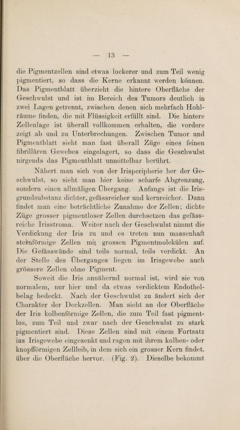 die Pigmentzellen sind etwas lockerer und zum Teil wenig pigmentiert, so dass die Kerne erkannt werden können. Das Pigmentblatt überzieht die hintere Oberfläche der Geschwulst und ist im Bereich des Tumors deutlich in zwei Lagen getrennt, zwischen denen sich mehrfach Hohl- räurne Anden, die mit Flüssigkeit erfüllt sind. Die hintere Zellenlage ist überall vollkommen erhalten, die vordere zeigt ab und zu Unterbrechungen. Zwischen Tumor und Pigmentblatt sieht man fast überall Züge eines feinen fibrillären Gewebes eingelagert, so dass die Geschwulst nirgends das Pigmentblatt unmittelbar berührt. Nähert man sich von der Irisperipherie her der Ge¬ schwulst, so sieht man hier keine scharfe Abgrenzung, sondern einen allmäligen Übergang. Anfangs ist die Iris- grundsubstanz dichter, gefässreiclier und kernreicher. Dann findet, man eine beträchtliche Zunahme der Zellen; dichte Züge grosser pigmentloser Zellen durchsetzen das gefäss- reiche Irisstroma. Weiter nach der Geschwulst nimmt die Verdickung der Iris zu und es treten nun massenhaft sternförmige Zellen mit grossen Pigmentmolekülen auf. Die Gefässwände sind teils normal, teils verdickt. An der Stelle des Überganges liegen im Irisgewebe auch grössere Zellen ohne Pigment. Soweit die Iris annähernd normal ist, wird sie von normalem, nur hier und da etwas verdicktem Endothel¬ belag bedeckt. Nach der Geschwulst zu ändert sich der Charakter der Deckzellen. Man sieht an der Oberfläche der Iris kolbenförmige Zellen, die zum Teil fast pigment¬ los, zum Teil und zwar nach der Geschwulst zu stark pigmentiert sind. Diese Zellen sind mit einem Fortsatz ins Irisgewebe eingesenkt und ragen mit ihrem kolben- oder knopftormigen Zellleib, in dem sich ein grosser Kern findet, über die Oberfläche hervor. (Fig. 2). Dieselbe bekommt