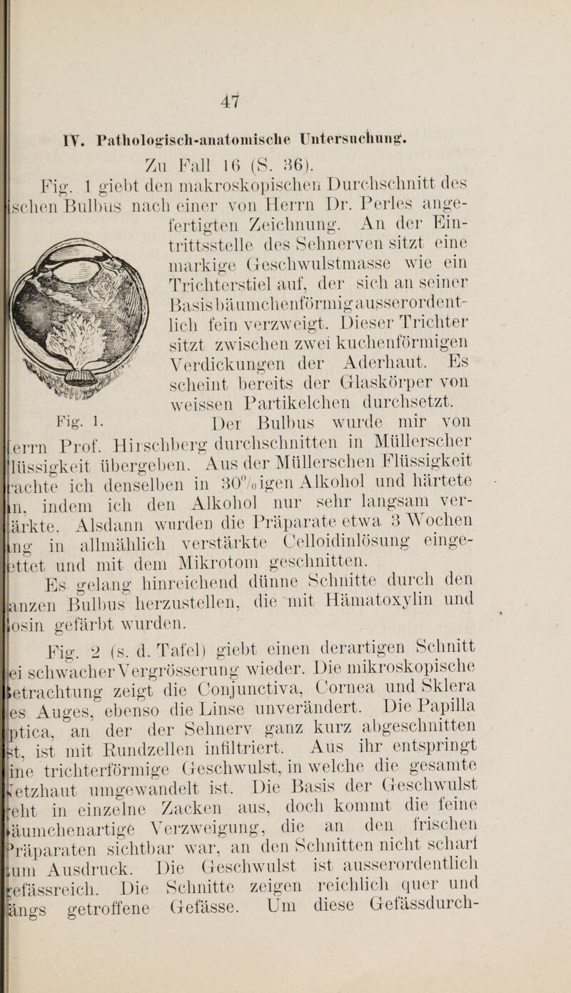 IY. Pathologisch-anatomische Untersuchung. Zu Fall 16 (S. 66). 171 • Mg. 1 giebt den makroskopischen Durchschnitt de; s cD --- 1 sehen Bulbus nach einer von Herrn Dr. Perles ange¬ fertigten Zeichnung. An der Ein¬ trittsstelle des Sehnerven sitzt eine markige Geschwulstmasse wie ein Fig. l. Trichterstiel auf, der sich an seiner Basis bäumchenförmig ausserordent¬ lich fein verzweigt. Dieser Trichter sitzt zwischen zwei kuchenförmigen Verdickungen der Aderhaut. Es scheint bereits der Glaskörper von weissen Partikelchen durchsetzt. Der Bulbus wurde mir von errn Prof. Hirschberg durchschnitten in Müllerscher ltissigkeit übergeben. Aus der Müllerschen Flüssigkeit achte ich denselben in 307oigen Alkohol und härtete m. indem ich den Alkohol nur sehr langsam ver- ärkte. Alsdann wurden die Präparate etwa 3 Wochen mg in allmählich verstärkte Celloidinlösung einge¬ bettet und mit dem Mikrotom geschnitten. Es gelang hinreichend dünne Schnitte durch den anzen Bulbus herzustellen, die mit Hämatoxylin und josin gefärbt wurden. Fig. 2 (s. d. Tafel) giebt einen derartigen Schnitt |ei schwacher Vergrösserung wieder. Die mikroskopische Betrachtung zeigt die Conjunctiva, Cornea und Sklera es Auges, ebenso die Linse unverändert. Die Papilla ptica, an der der Sehnerv ganz kurz abgeschnitten 4. ist mit Rundzellen infiltriert. Aus ihr entspringt ine trichterförmige Geschwulst, in welche die gesamte letzhaut umgewandelt ist. Die Basis der Geschwulst eht in einzelne Zacken aus, doch kommt die. leine äumchenartige Verzweigung, die an den Irischen Täparaten sichtbar war, an den Schnitten nicht scliarl um Ausdruck. Die Geschwulst ist. ausserordentlich •efässreich. Die Schnitte zeigen reichlich quer und ängs getroffene Gefässe. Um diese Gelässdurcli-