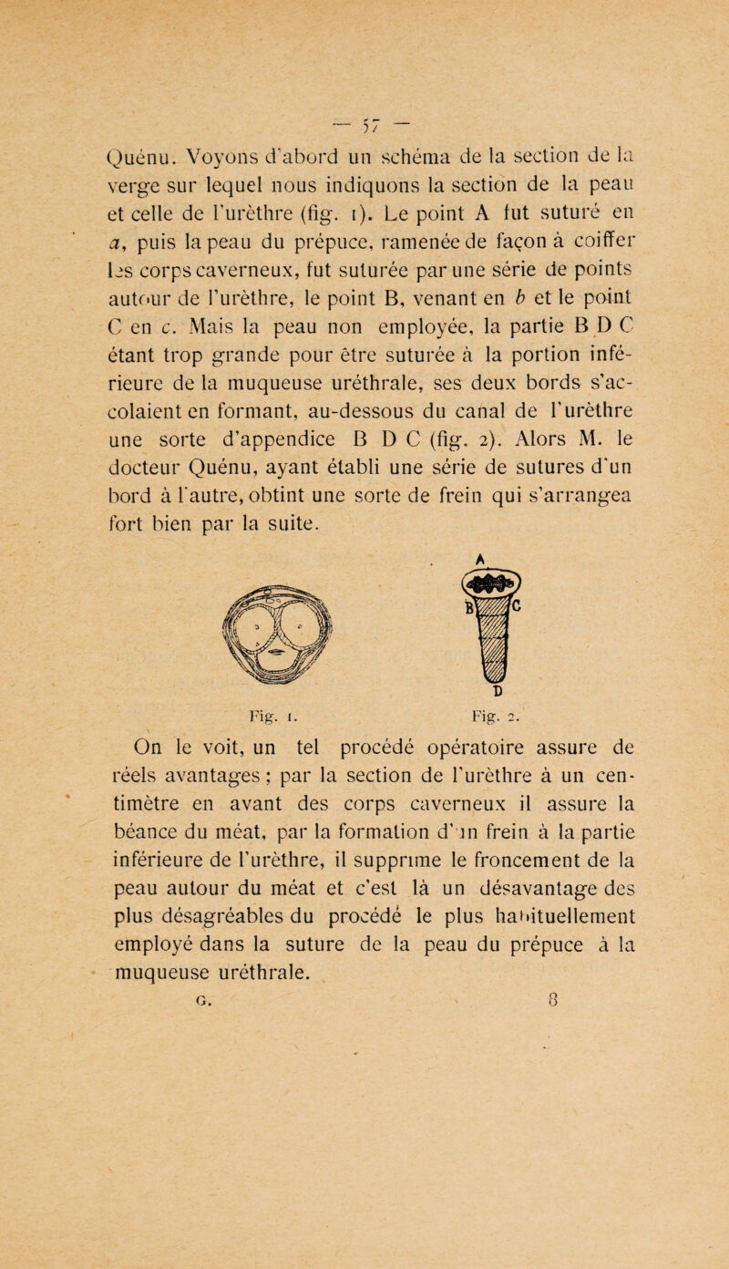 Quénu. Voyons d'abord un schéma de la section de la verge sur lequel nous indiquons la section de la peau et celle de Turèthre (fig. i). Le point A tut suturé en a, puis la peau du prépuce, ramenée de façon à coiffer les corps caverneux, fut suturée par une série de points autr.ur de Turèthre, le point B, venant en b et le point C en c. Mais la peau non employée, la partie B D C étant trop grande pour être suturée à la portion infé¬ rieure de la muqueuse uréthrale, ses deux bords s’ac¬ colaient en formant, au-dessous du canal de l’urèthre une sorte d’appendice B D C (fig. 2). Alors M. le docteur Quénu, ayant établi une série de sutures d'un bord à l'autre, obtint une sorte de frein qui s’arrangea fort bien par la suite. A D Fig. I. Fig. 2. On le voit, un tel procédé opératoire assure de réels avantages; par la section de l’urèthre à un cen¬ timètre en avant des corps caverneux il assure la béance du méat, par la formation d’un frein à la partie inférieure de l’urèthre, il supprime le froncement de la peau autour du méat et c’est là un désavantage des plus désagréables du procédé le plus habituellement employé dans la suture de la peau du prépuce à la muqueuse uréthrale.
