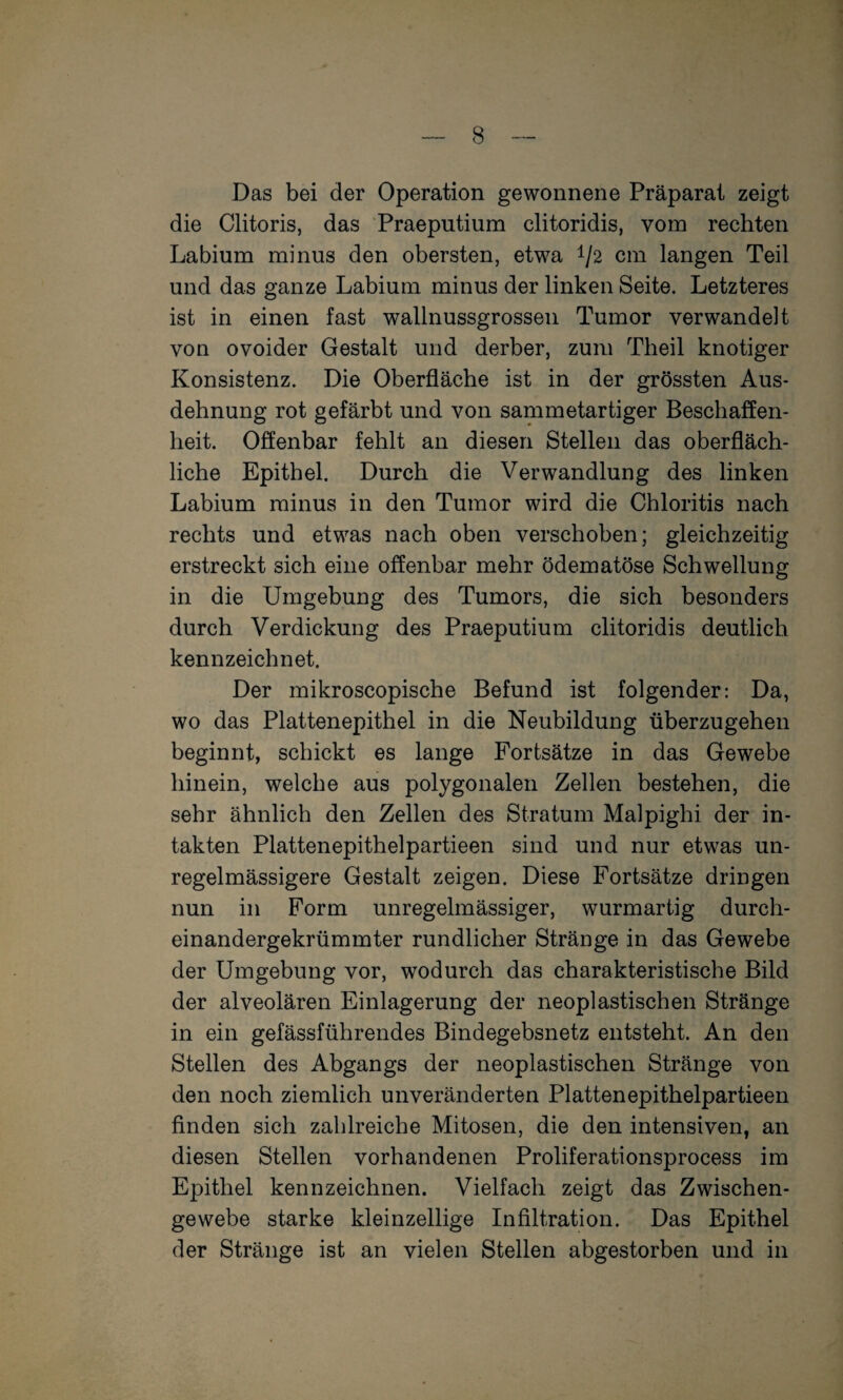 Das bei der Operation gewonnene Präparat zeigt die Clitoris, das Praeputium clitoridis, vom rechten Labium minus den obersten, etwa 1/2 cm langen Teil und das ganze Labium minus der linken Seite. Letzteres ist in einen fast wallnussgrossen Tumor verwandelt von ovoider Gestalt und derber, zum Theil knotiger Konsistenz. Die Oberfläche ist in der grössten Aus¬ dehnung rot gefärbt und von sammetartiger Beschaffen¬ heit. Offenbar fehlt an diesen Stellen das oberfläch¬ liche Epithel. Durch die Verwandlung des linken Labium minus in den Tumor wird die Chloritis nach rechts und etwas nach oben verschoben; gleichzeitig erstreckt sich eine offenbar mehr ödematöse Schwellung in die Umgebung des Tumors, die sich besonders durch Verdickung des Praeputium clitoridis deutlich kennzeichnet. Der mikroscopische Befund ist folgender: Da, wo das Plattenepithel in die Neubildung überzugehen beginnt, schickt es lange Fortsätze in das Gewebe hinein, welche aus polygonalen Zellen bestehen, die sehr ähnlich den Zellen des Stratum Malpighi der in¬ takten Plattenepithelpartieen sind und nur etwas un¬ regelmässigere Gestalt zeigen. Diese Fortsätze dringen nun in Form unregelmässiger, wurmartig durch¬ einandergekrümmter rundlicher Stränge in das Gewebe der Umgebung vor, wodurch das charakteristische Bild der alveolären Einlagerung der neoplastischen Stränge in ein gefässführendes Bindegebsnetz entsteht. An den Stellen des Abgangs der neoplastischen Stränge von den noch ziemlich unveränderten Plattenepithelpartieen finden sich zahlreiche Mitosen, die den intensiven, an diesen Stellen vorhandenen Proliferationsprocess im Epithel kennzeichnen. Vielfach zeigt das Zwischen¬ gewebe starke kleinzellige Infiltration. Das Epithel der Stränge ist an vielen Stellen abgestorben und in