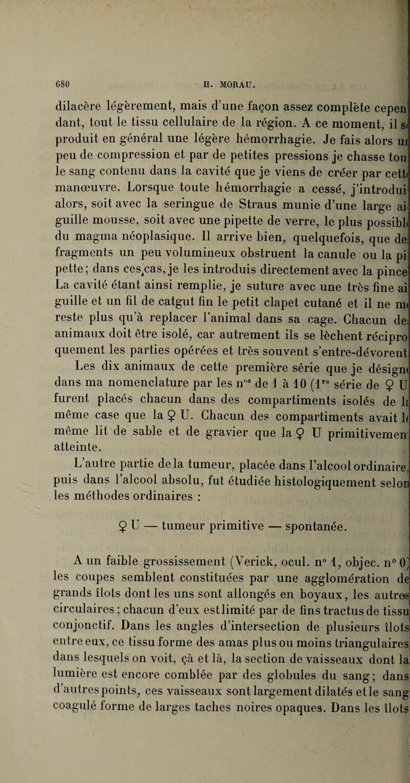 dilacère légèrement, mais d une façon assez complète cepeni dant, tout le tissu cellulaire de la région. A ce moment, il si produit en général une légère hémorrhagie. Je fais alors ui peu de compression et par de petites pressions je chasse tou le sang contenu dans la cavité que je viens de créer par cett< manœuvre. Lorsque toute hémorrhagie a cessé, j’introdui alors, soit avec la seringue de Straus munie d une large ai guille mousse, soit avec une pipette de verre, le plus possibL du magma néoplasique. Il arrive bien, quelquefois, que de fragments un peu volumineux obstruent la canule ou la pi pette; dans cessas, je les introduis directement avec la pince La cavité étant ainsi remplie, je suture avec une très fine ai guille et un fil de catgut fin le petit clapet cutané et il ne m< reste plus qu’à replacer l’animal dans sa cage. Chacun de; animaux doit être isolé, car autrement ils se lèchent récipro quement les parties opérées et très souvent s’entre-dévorent Les dix animaux de cette première série que je désigm dans ma nomenclature par les nos de 1 à 10 (lre série de Ç U furent placés chacun dans des compartiments isolés de h même case que la Ç U. Chacun des compartiments avait h même lit de sable et de gravier que la Ç U primitivemen atteinte. L autre partie delà tumeur, placée dans l’alcool ordinaire, puis dans 1 alcool absolu, fut étudiée histologiquement selon les méthodes ordinaires : 2 U — tumeur primitive — spontanée. A un faible grossissement (Verick, ocul. n° 1, objec. n° 0’ les coupes semblent constituées par une agglomération de grands îlots dont les uns sont allongés en boyaux, les autres circulaires ; chacun d’eux estlimité par de fins tractusde tissu conjonctif. Dans les angles d’intersection de plusieurs îlots entre eux, ce tissu forme des amas plus ou moins triangulaires dans lesquels on voit, çà et là, la section de vaisseaux dont la lumière est encore comblée par des globules du sang; dans d’autres points, ces vaisseaux sont largement dilatés et le sang coagulé forme de larges taches noires opaques. Dans les îlots