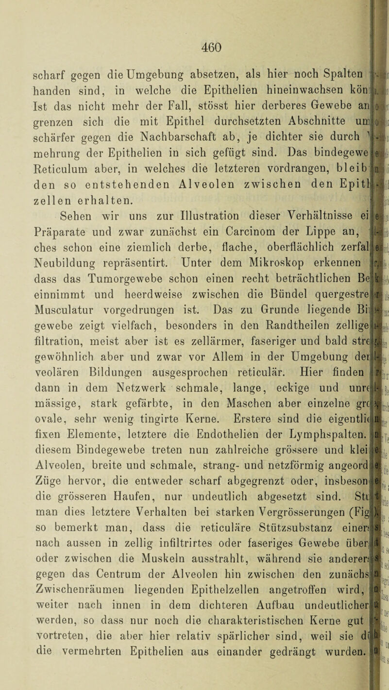 scharf gegen die Umgebung absetzen, als hier noch Spalten j - handen sind, in welche die Epithelien hineinwachsen kön ji. Ist das nicht mehr der Fall, stösst hier derberes Gewebe anja grenzen sich die mit Epithel durchsetzten Abschnitte unojo schärfer gegen die Nachbarschaft ab, je dichter sie durch 1 - mehrung der Epithelien in sich gefügt sind. Das bindegewe e Reticulum aber, in welches die letzteren vordrangen, bleib Ijil' n den so entstehenden Alveolen zwischen den EpitilJ zellen erhalten. • '1 H Sehen wir uns zur Illustration dieser Verhältnisse ei eh Präparate und zwar zunächst ein Carcinom der Lippe an, iw ches schon eine ziemlich derbe, flache, oberflächlich zerfall e.U Neubildung repräsentirt. Unter dem Mikroskop erkennen jr| dass das Tumorgewebe schon einen recht beträchtlichen Be|kß einnimmt und heerdweise zwischen die Bündel quergestrell Musculatur vorgedrungen ist. Das zu Grunde liegende Bi» gewebe zeigt vielfach, besonders in den Randtheilen zelligepif filtration, meist aber ist es zellärmer, faseriger und bald streHg gewöhnlich aber und zwar vor Allem in der Umgebung derljli veolären Bildungen ausgesprochen reticulär. Hier finden in dann in dem Netzwerk schmale, lange, eckige und unrejk mässige, stark gefärbte, in den Maschen aber einzelne grc >, ovale, sehr wenig tingirte Kerne. Erstere sind die eigentliq n fixen Elemente, letztere die Endothelien der Lymphspalten, n diesem Bindegewebe treten nun zahlreiche grössere und klei i$j Alveolen, breite und schmale, sträng- und netzförmig angeord e Züge hervor, die entweder scharf abgegrenzt oder, insbeson e die grösseren Haufen, nur undeutlich abgesetzt sind. Still man dies letztere Verhalten bei starken Vergrösserungen (Figl), so bemerkt man, dass die reticuläre Stützsubstanz einerlj nach aussen in zellig infiltrirtes oder faseriges Gewebe üben st oder zwischen die Muskeln ausstrahlt, während sie andereres gegen das Centrum der Alveolen hin zwischen den zunächst Zwischenräumen liegenden Epithelzellen angetroffen wird, ß weiter nach innen in dem dichteren Aufbau undeutlicher ß werden, so dass nur noch die charakteristischen Kerne gut U vortreten, die aber hier relativ spärlicher sind, weil sie dlÄ die vermehrten Epithelien aus einander gedrängt wurden, ß
