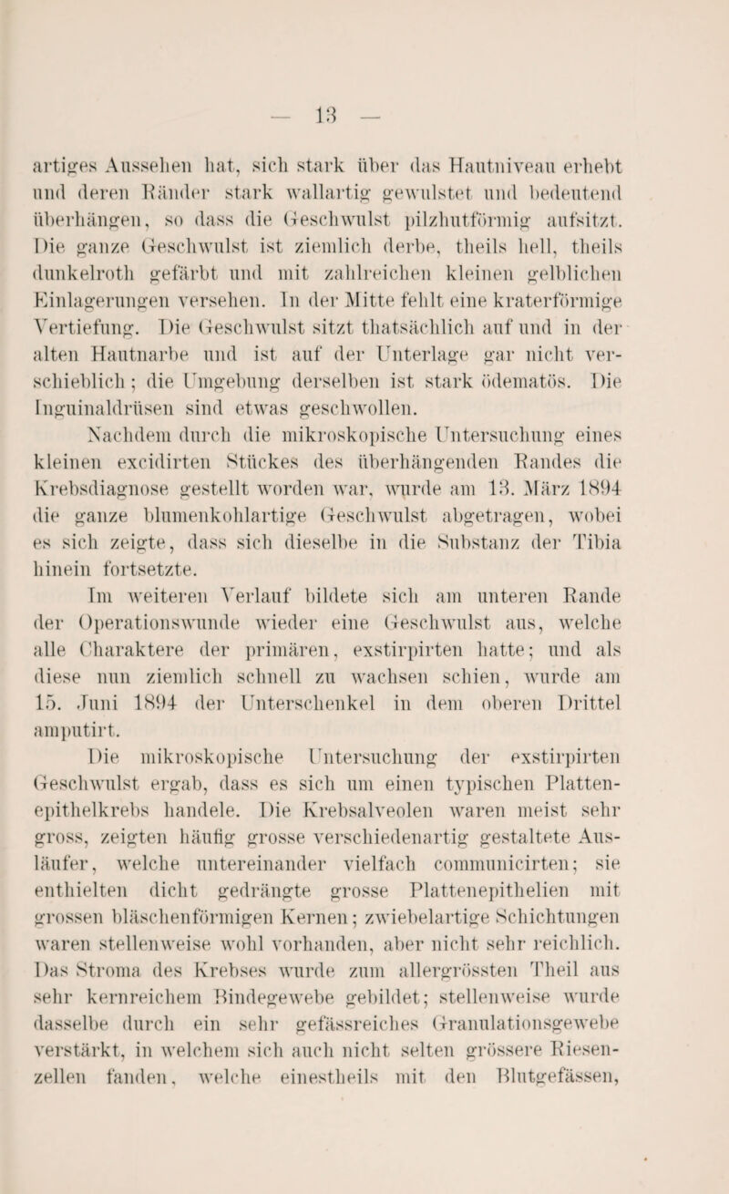 artiges Aussehen hat, sich stark über das Hautniveau erhebt und deren Ränder stark wallartig gewulstet und bedeutend Überhängen, so dass die Geschwulst pilzhutförmig aufsitzt. Die ganze Geschwulst ist ziemlich derbe, theils hell, theils dunkelroth gefärbt und mit zahlreichen kleinen gelblichen Einlagerungen versehen. In der Mitte fehlt eine kraterförmige Vertiefung. Die Geschwulst sitzt thatsächlich auf und in der alten Hautnarbe und ist auf der Unterlage gar nicht ver¬ schieblich ; die Umgebung derselben ist stark ödematös. Die Inguinaldrüsen sind etwas geschwollen. Nachdem durch die mikroskopische Untersuchung eines kleinen excidirten Stückes des überhängenden Randes die Krebsdiagnose gestellt worden war, wurde am 13. März 1894 die ganze blumenkohlartige Geschwulst abgetragen, wobei es sich zeigte, dass sich dieselbe in die Substanz der Tibia hinein fortsetzte. Im weiteren Verlauf bildete sich am unteren Rande der Operationswunde wieder eine Geschwulst aus, welche alle Charaktere der primären, exstirpirten hatte; und als diese nun ziemlich schnell zu wachsen schien, wurde am 15. Juni 1894 der Unterschenkel in dem oberen Drittel amputirt. Die mikroskopische Untersuchung der exstirpirten Geschwulst ergab, dass es sich um einen typischen Platten¬ epithelkrebs handele. Die Krebsalveolen waren meist sehr gross, zeigten häufig grosse verschiedenartig gestaltete Aus¬ läufer, welche untereinander vielfach communicirten; sie enthielten dicht gedrängte grosse Plattenepithelien mit grossen bläschenförmigen Kernen; zwiebelartige Schichtungen waren stellenweise wohl vorhanden, aber nicht sehr reichlich. Das Stroma des Krebses wurde zum allergrössten Theil aus sehr kernreichem Bindegewebe gebildet; stellenweise wurde dasselbe durch ein sehr gefässreiches Granulationsgewebe verstärkt, in welchem sich auch nicht selten grössere Riesen¬ zellen fänden, welche einestheils mit den Blutgefässen,