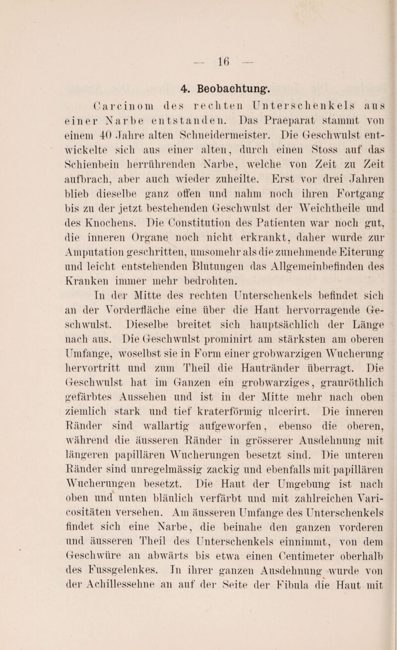 4. Beobachtung*. Carcinom des rechten Unterschenkels aus einer Narbe entstanden. Das Praeparat stammt von einem 40 Jahre alten Schneidermeister. Die Geschwulst ent¬ wickelte sich aus einer alten, durch einen Stoss auf das Schienbein herrührenden Narbe, welche von Zeit zu Zeit aufbrach, aber auch wieder zuheilte. Erst vor drei Jahren blieb dieselbe ganz offen und nahm noch ihren Fortgang bis zu der jetzt bestehenden Geschwulst der Weichtheile und des Knochens. Die Constitution des Patienten war noch gut, die inneren Organe noch nicht erkrankt, daher wurde zur Amputation geschritten, umsomehr als die zunehmende Eiterung und leicht entstehenden Blutungen das Allgemeinbefinden des Kranken immer mehr bedrohten. In der Mitte des rechten Unterschenkels befindet sich an der Vorderfläche eine über die Haut hervorragende Ge¬ schwulst. Dieselbe breitet sich hauptsächlich der Länge nach aus. Die Geschwulst prominirt am stärksten am oberen Umfange, woselbst sie in Form einer grobwarzigen Wucherung hervortritt und zum Theil die Hautränder überragt. Die Geschwulst hat im Ganzen ein grob warziges, grauröthlich gefärbtes Aussehen und ist in der Mitte mehr nach oben ziemlich stark und tief kraterförmig ulcerirt. Die inneren Bänder sind wallartig aufgeworfen, ebenso die oberen, während die äusseren Ränder in grösserer Ausdehnung mit längeren papillären Wucherungen besetzt sind. Die unteren Bänder sind unregelmässig zackig und ebenfalls mit papillären Wucherungen besetzt. Die Haut der Umgebung ist nach oben und unten bläulich verfärbt und mit zahlreichen Vari- cositäten versehen. Am äusseren Umfange des Unterschenkels findet sich eine Narbe, die beinahe den ganzen vorderen und äusseren Theil des Unterschenkels einnimmt, von dem Geschwüre an abwärts bis etwa einen Centimeter oberhalb des Fussgelenkes. In ihrer ganzen Ausdehnung wurde von der Achillessehne an auf der Seite der Fibula die Haut mit