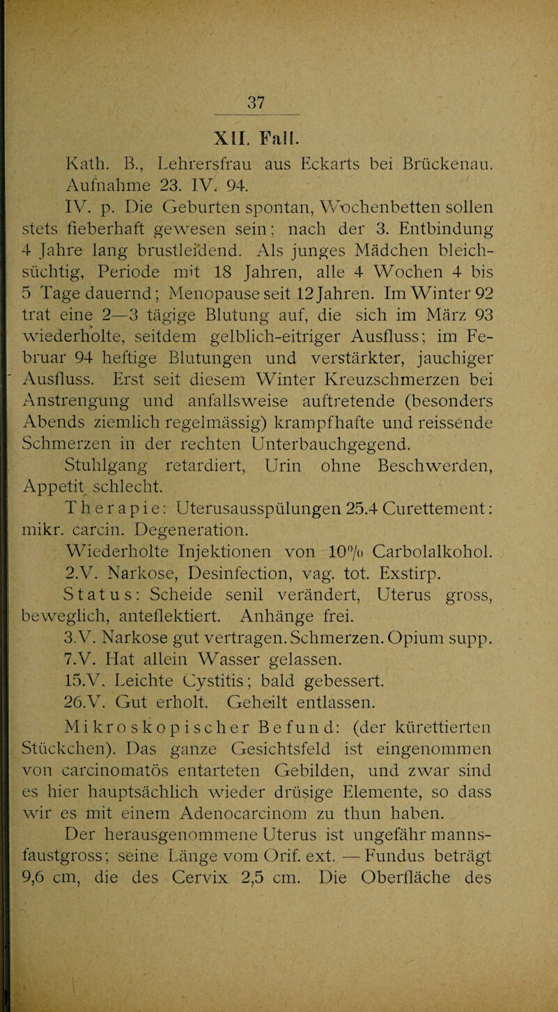 XIL Fall. Kath. B., Lehrersfrau aus Eckarts bei Brückenau. Aufnahme 23. IV. 94. IV. p. Die Geburten spontan, Wochenbetten sollen stets fieberhaft gewesen sein; nach der 3. Entbindung 4 Jahre lang brustleidend. Als junges Mädchen bleich¬ süchtig, Periode mit 18 Jahren, alle 4 Wochen 4 bis 5 Tage dauernd; Menopause seit 12 Jahren. Im Winter 92 trat eine 2—3 tägige Blutung auf, die sich im März 93 wiederholte, seitdem gelblich-eitriger Ausfluss; im Fe¬ bruar 94 heftige Blutungen und verstärkter, jauchiger Ausfluss. Erst seit diesem Winter Kreuzschmerzen bei Anstrengung und anfallsweise auftretende (besonders Abends ziemlich regelmässig) krampfhafte und reissende Schmerzen in der rechten Unterbauchgegend. Stuhlgang retardiert, Urin ohne Beschwerden, Appetit schlecht. Therapie: Uterusausspülungen 25.4 Curettement: mikr. carcin. Degeneration. Wiederholte Injektionen von 10% Carboialkohol. 2. V. Narkose, Desinfection, vag. tot. Exstirp. Status: Scheide senil verändert, Uterus gross, beweglich, anteflektiert. Anhänge frei. 3. V. Narkose gut vertragen. Schmerzen. Opium supp. 7.V. Hat allein Wasser gelassen. 15.V., Leichte Cystitis; bald gebessert. 26.V. Gut erholt. Geheilt entlassen. Mikroskopischer Befund: (der kürettierten Stückchen). Das ganze Gesichtsfeld ist eingenommen von carcinomatös entarteten Gebilden, und zwar sind es hier hauptsächlich wieder drüsige Elemente, so dass wir es mit einem Adenocarcinom zu thun haben. Der herausgenommene Uterus ist ungefähr manns¬ faustgross; seine Länge vom Orif. ext. -—-Fundus beträgt 9,6 cm, die des Cervix 2,5 cm. Die Oberfläche des