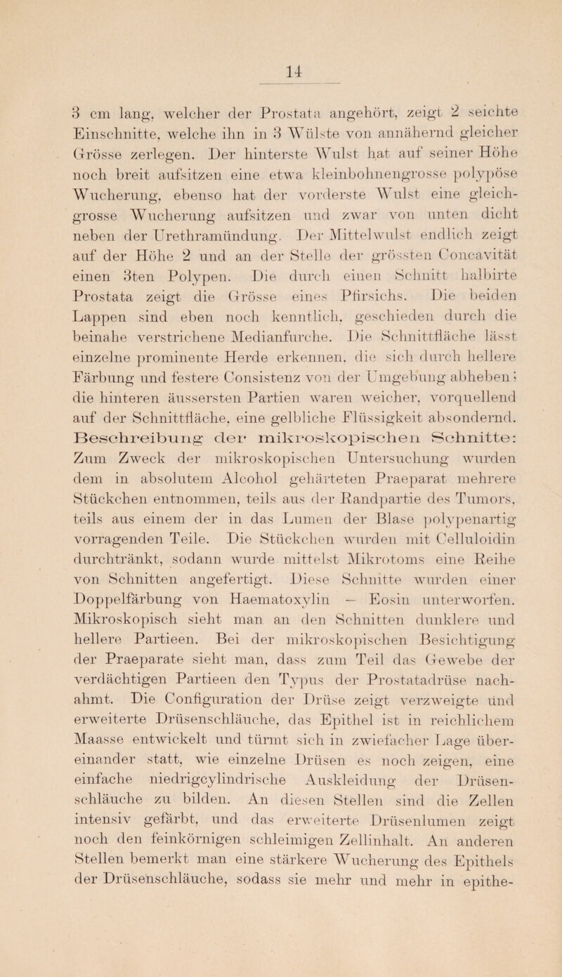 3 cm lang, welcher der Prostata angehört, zeigt 2 seichte Einschnitte, welche ihn in 3 Wülste von annähernd gleicher Grösse zerlegen. Der hinterste Wulst hat auf seiner Höhe noch breit aufsitzen eine etwa kleinbohnengrosse polypöse Wucherung, ebenso hat der vorderste A\ ulst eine gleich- grosse Wucherung aufsitzen und zwar von unten dicht neben der Urethramündung. Der Mittelwulst endlich zeigt auf der Höhe 2 und an der Stelle der grössten Concavität einen 3ten Polypen. Die durch einen Schnitt halbirte Prostata zeigt die Grösse eines Pfirsichs. Die beiden Lappen sind eben noch kenntlich, geschieden durch die beinahe verstrichene Medianfurche. Die Schnittfläche lässt einzelne prominente Herde erkennen, die sich durch hellere Färbung und festere Consistenz von der Umgebung abheben? die hinteren äussersten Partien waren weicher, vorquellend auf der Schnittfläche, eine gelbliche Flüssigkeit absondernd. Beschreibung der mikroskopischen Schnitte: Zum Zweck der mikroskopischen Untersuchung wurden dem in absolutem Alcohol gehärteten Praeparat mehrere Stückchen entnommen, teils aus der Randpartie des Tumors, teils aus einem der in das Lumen der Blase polypenartig vorragenden Teile. Die Stückchen wurden mit Celluloidin durchtränkt, sodann wurde mittelst Mikrotoms eine Reihe von Schnitten angefertigt. Diese Schnitte wurden einer Doppelfärbung von Haematoxylin — Eosin unterworfen. Mikroskopisch sieht man an den Schnitten dunklere und hellere Partieen. Bei der mikroskopischen Besichtigung der Praeparate sieht man, dass zum Teil das Gewebe der verdächtigen Partieen den Typus der Prostatadrüse nach¬ ahmt. Die Configuration der Drüse zeigt verzweigte und erweiterte Drüsenschläuche, das Epithel ist in reichlichem Maasse entwickelt und türmt sich in zwiefacher Lage über¬ einander statt, wie einzelne Drüsen es noch zeigen, eine einfache niedrigcylindrisclie Auskleidung der Drüsen¬ schläuche zu bilden. An diesen Stellen sind die Zellen intensiv gefärbt, und das erweiterte Drüsenlumen zeigt noch den feinkörnigen schleimigen Zellinhalt. An anderen Stellen bemerkt man eine stärkere Wucherung des Epithels der Drüsenschläuche, sodass sie mehr und mehr in epithe-