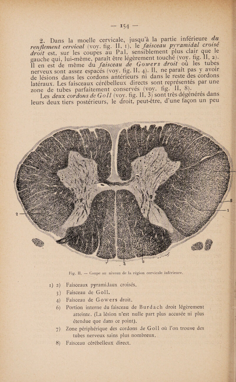 2. Dans la moelle cervicale, jusqu’à la partie inférieure du renflement cervical (voy. fig. II, i), le faisceau pyramidal croise droit est, sur les coupes au Pal, sensiblement plus clan que le gauche qui, lui-même, paraît être légèrement touché (voy. fig- H, 2). 11 en est de même du faisceau de G orner s droit où les tubes nerveux sont assez espacés (voy. fig. II, 4)- ne Para*t Pas Y avcar de lésions dans les cordons antérieurs ni dans le reste des cordons latéraux. Les faisceaux cérébelleux directs sont représentés par une zone de tubes parfaitement conservés (voy. fig. II, S). , , Les deux cordons de Go II (voy. fig. II, 3) sont très dégénérés dans leurs deux tiers postérieurs, le droit, peut-être, d’une façon un peu Fig. II. — Coupe au niveau de la région cervicale inférieure. i) 2) Faisceaux pyramidaux croisés. 3) Faisceau de Goll. 4) Faisceau de Gowers droit. 6) Portion interne du faisceau de Burdach droit légèrement atteinte. (La lésion n’est nulle part plus accusée ni plus étendue que dans ce point). 7) Zone périphérique des cordons de Goll où l’on trouve des tubes nerveux sains plus nombreux. 8) Faisceau cérébelleux direct.