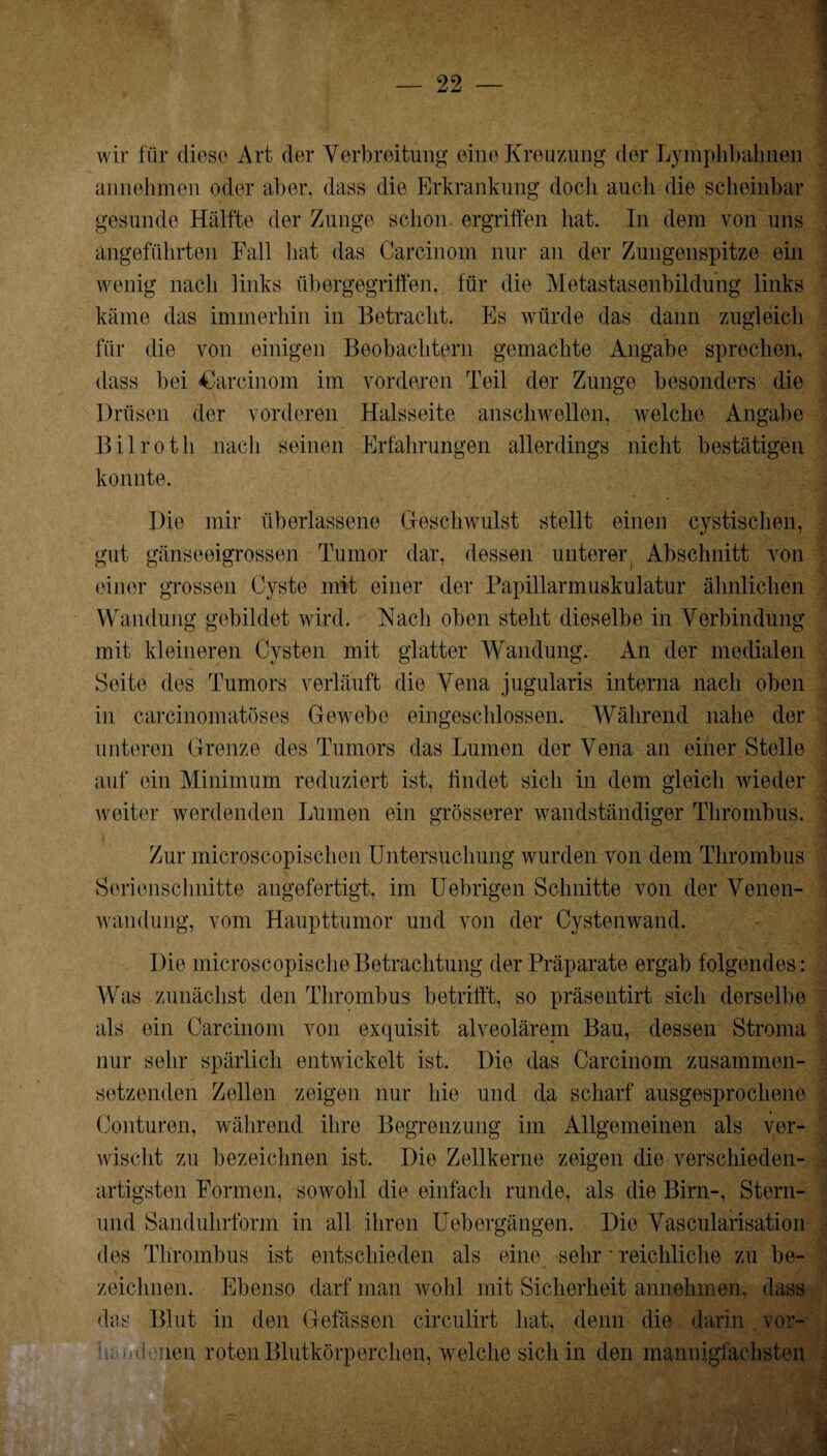 wir für diese Art der Verbreitung eine Kreuzung der Lymphbahnen annehmen oder aber, dass die Erkrankung doch auch die scheinbar gesunde Hälfte der Zunge schon ergriffen hat. In dem von uns angeführten Fall hat das Carcinom nur an der Zungenspitze ein wenig nach links übergegriffen, für die Metastasenbildung links käme das immerhin in Betracht. Es würde das dann zugleich für die von einigen Beobachtern gemachte Angabe sprechen, dass bei <0arcinom im vorderen Teil der Zunge besonders die Drüsen der vorderen Halsseite anschwellen, welche Angabe Bilroth nach seinen Erfahrungen allerdings nicht bestätigen konnte. Die mir überlassene Geschwulst stellt einen cystischen, gut gänseeigrossen Tumor dar, dessen unterer Abschnitt von einer grossen Cyste mit einer der Papillarmuskulatur ähnlichen Wandung gebildet wird. Nach oben steht dieselbe in Verbindung mit kleineren Cysten mit glatter Wandung. An der medialen Seite des Tumors verläuft die Vena jugularis interna nach oben in carcinomatöses Gewebe eingeschlossen. Während nahe der unteren Grenze des Tumors das Lumen der Vena an einer Stelle auf ein Minimum reduziert ist, findet sich in dem gleich wieder weiter werdenden Lumen ein grösserer wandständiger Thrombus. Zur microscopischen Untersuchung wurden von dem Thrombus Serienschnitte angefertigt, im Uebrigen Schnitte von der Venen¬ wandung, vom Haupttumor und von der Cystenwand. Die microscopische Betrachtung der Präparate ergab folgendes : Was zunächst den Thrombus betrifft, so präsentirt sich derselbe als ein Carcinom von exquisit alveolärem Bau, dessen Stroma nur sehr spärlich entwickelt ist. Die das Carcinom zusammen¬ setzenden Zellen zeigen nur hie und da scharf ausgesprochene j Conturen, während ihre Begrenzung im Allgemeinen als ver¬ wischt zu bezeichnen ist. Die Zellkerne zeigen die verschieden¬ artigsten Formen, sowohl die einfach runde, als die Birn-, Stern- und Sanduhrform in all ihren Uebergängen. Die Vascularisation des Thrombus ist entschieden als eine sehr • reichliche zu be¬ zeichnen. Ebenso darf man wohl mit Sicherheit annehmen, dass das Blut in den Gelassen circulirt hat, denn die darin vor- e ■neu roten Blutkörperchen, welche sich in den mannigfachsten
