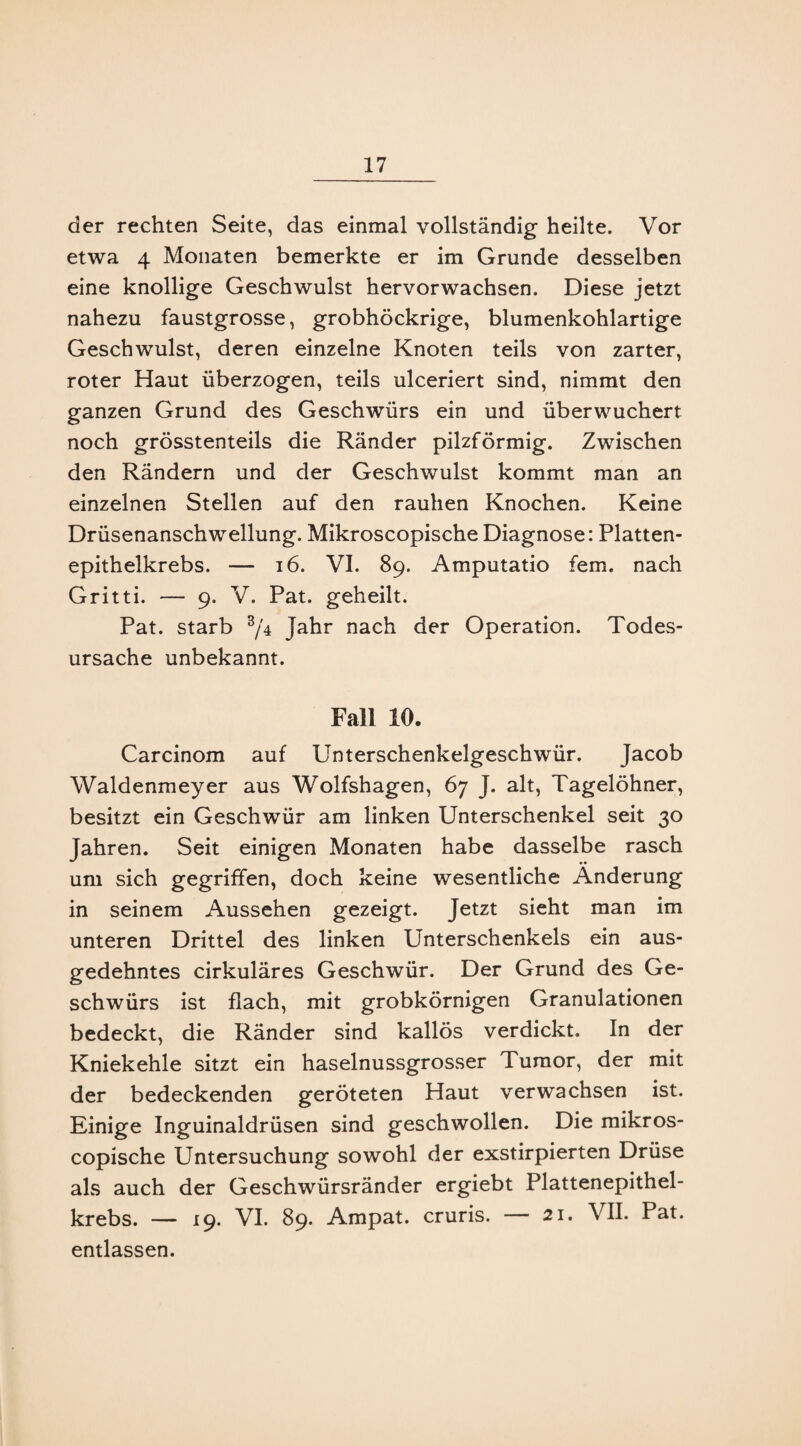 der rechten Seite, das einmal vollständig heilte. Vor etwa 4 Monaten bemerkte er im Grunde desselben eine knollige Geschwulst hervorwachsen. Diese jetzt nahezu faustgrosse, grobhöckrige, blumenkohlartige Geschwulst, deren einzelne Knoten teils von zarter, roter Haut überzogen, teils ulceriert sind, nimmt den ganzen Grund des Geschwürs ein und überwuchert noch grösstenteils die Ränder pilzförmig. Zwischen den Rändern und der Geschwulst kommt man an einzelnen Stellen auf den rauhen Knochen. Keine Drüsenanschwellung. Mikroscopische Diagnose: Platten¬ epithelkrebs. — 16. VI. 89. Amputatio fern, nach Gritti. — 9. V. Pat. geheilt. Pat. starb 3/4 Jahr nach der Operation. Todes¬ ursache unbekannt. Fall 10. Carcinom auf Unterschenkelgeschwür. Jacob Waldenmeyer aus Wolfshagen, 67 J. alt, Tagelöhner, besitzt ein Geschwür am linken Unterschenkel seit 30 Jahren. Seit einigen Monaten habe dasselbe rasch um sich gegriffen, doch keine wesentliche Änderung in seinem Aussehen gezeigt. Jetzt sieht man im unteren Drittel des linken Unterschenkels ein aus¬ gedehntes cirkuläres Geschwür. Der Grund des Ge¬ schwürs ist flach, mit grobkörnigen Granulationen bedeckt, die Ränder sind kallös verdickt. In der Kniekehle sitzt ein haselnussgrosser Tumor, der mit der bedeckenden geröteten Haut verwachsen ist. Einige Inguinaldrüsen sind geschwollen. Die mikros¬ copische Untersuchung sowohl der exstirpierten Drüse als auch der Geschwürsränder ergiebt Plattenepithel¬ krebs. — 19. VI. 89. Ampat. cruris. — 21. VII. Pat. entlassen.