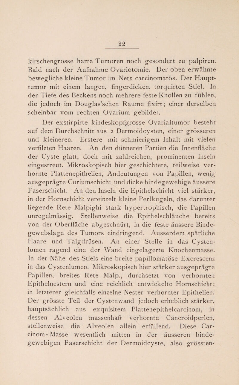 kirschengrosse harte Tumoren noch gesondert zu palpiren. Bald nach der Aufnahme Ovariotomie. Der oben erwähnte bewegliche kleine Tumor im Netz carcinomatös. Der Haupt¬ tumor mit einem langen, fingerdicken, torquirten Stiel. In der Tiefe des Beckens noch mehrere feste Knollen zu fühlen, die jedoch im Douglas’schen Raume fixirt; einer derselben scheinbar vom rechten Ovarium gebildet. Der exstirpirte kindeskopfgrosse Ovarialtumor besteht auf dem Durchschnitt aus 2 Dermoidcysten, einer grösseren und kleineren. Erstere mit schmierigem Inhalt mit vielen verfdzten Haaren. An den dünneren Partien die Innenfläche der Cyste glatt, doch mit zahlreichen, prominenten Inseln eingestreut. Mikroskopisch hier geschichtete, teilweise ver¬ hornte Plattenepithelien, Andeutungen von Papillen, wenig ausgeprägte Coriumschicht und dicke bindegewebige äussere Faserschicht. An den Inseln die Epithelschicht viel stärker, in der Hornschicht vereinzelt kleine Perlkugeln, das darunter liegende Rete Malpighi stark hypertrophisch, die Papillen unregelmässig. Stellenweise die Epithelschläuche bereits von der Oberfläche abgeschnürt, in die feste äussere Binde- gewebslage des Tumors eindringend. Ausserdem spärliche Haare und Talgdrüsen. An einer Stelle in das Cysten- lu.men ragend eine der Wand eingelagerte Knochenmasse. In der Nähe des Stiels eine breite papillomatöse Excrescenz in das Cystenlumen. Mikroskopisch hier stärker ausgeprägte Papillen, breites Rete Malp., durchsetzt von verhornten Epithelnestern und eine reichlich entwickelte Hornschicht; in letzterer gleichfalls einzelne Nester verhornter Epithelien. Der grösste Teil der Cystenwand jedoch erheblich stärker, hauptsächlich aus exquisitem Plattenepithelcarcinom, in dessen Alveolen massenhaft verhornte Cancroidperlen, stellenweise die Alveolen allein erfüllend. Diese Car- cinom-Masse wesentlich mitten in der äusseren binde¬ gewebigen Faserschicht der Dermoidcyste, also grössten-