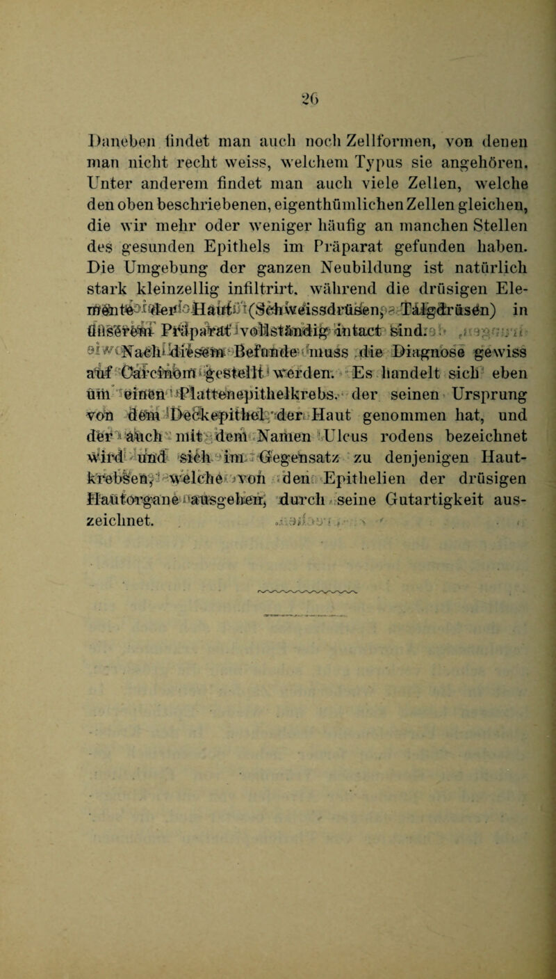 Daneben bildet man auch noch Zellformen, von denen man nicht recht weiss, welchem Typus sie angehören. Unter anderem bildet man auch viele Zellen, welche den oben beschriebenen, eigentümlichen Zellen gleichen, die wir mehr oder weniger häufig an manchen Stellen des gesunden Epithels im Präparat gefunden haben. Die Umgebung der ganzen Neubildung ist natürlich stark kleinzellig infiltrirt. während die drüsigen Eie¬ rn $n ctei*UJHatdb t(Schw^issdrtiäenp? Tilgdrüs4n) in öils^rönf Pbilparäf^vollständig dntact feind. : F; ; i öi wi Naclndiesem Befunde muss die Diagnose gewiss auf Oarcinöirt gestellti werden. Es handelt sich eben üiii deinen •Plattenepithelkrebs, der seinen Ursprung von dfem Deb'kej>itheUdo r Ha ut genommen hat, und der^ ädch ^ mit ■ den! Namen Ulcus rodens bezeichnet Wird und sich Tun: Gegensatz zu denjenigen Haut- welche iVöfi den Epithelien der drüsigen fl au t organ e uusgeheir, durch seine Gutartigkeit aus¬ zeichnet. > ' • «;