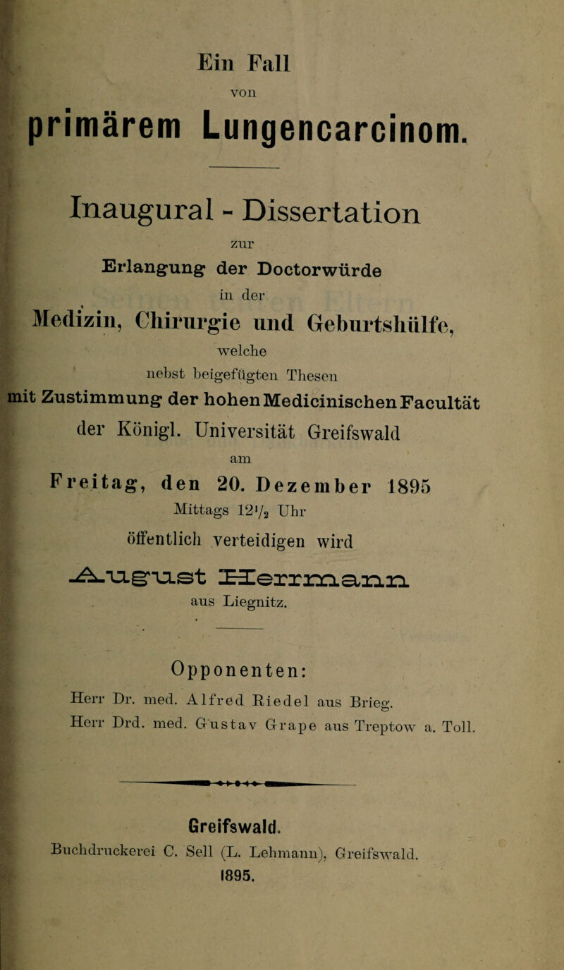 Ein Fall von primärem Lungencarcinom. Inaugural - Dissertation zur > Erlangung der Doctorwürde in der Medizin, Chirurgie und Geburtsliülfe, welche nebst beigefügten Thesen mit Zustimmung der hohen Medicinischen Facultät der Königl. Universität Greifswald am Freitag, den 20. Dezember 1895 Mittags 12*/a Uhr öffentlich verteidigen wird -A-ia-grust I^errmann aus Liegnitz. Opponenten: Herr Dr. med. Alfred Riedel aus Briem O Herr Drd. med. Gustav Grape aus Treptow a. Toll. Greifswald. Buchdruckerei C. Seil (L. Lehmann), Greifswald. 1895.