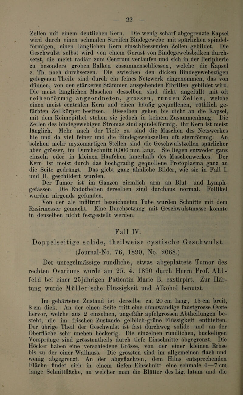 Zellen mit einem deutlichen Kern. Die wenig scharf abgegrenzte Kapsel wird durch einen schmalen Streifen Bindegewebe mit spärlichen spindel¬ förmigen, einen länglichen Kern einschliessenden Zellen gebildet. Die Geschwulst selbst wird von einem Gerüst von ßindegewebsbalken durch¬ setzt, die meist radiär zum Centrum verlaufen und sich in der Peripherie zu besonders groben Balken znsammenschliessen, welche die Kapsel z. Th. noch durchsetzen. Die zwischen den dicken Bindegewrebsziigen gelegenen Theile sind durch ein feines Netzwerk eingenommen, das von dünnen, von den stärkeren Stämmen ausgehenden Fibrillen gebildet wird. Die meist länglichen Maschen desselben sind dicht angefüllt mit oft reihenförmig angeordneten, grossen, runden Zellen, wTelche einen meist centralen Kern und einen häufig gequollenen, röthlich ge¬ färbten Zellkörper besitzen. Dieselben gehen bis dicht an die Kapsel, mit dem Keimepithel stehen sie jedoch in keinem Zusammenhang. Die Zellen des bindegewebigen Stromas sind spindelförmig, ihr Kern ist meist länglich. Mehr nach der Tiefe zu sind die Maschen des Netzwerkes hie und da viel feiner und die Bindegewrebszellen oft sternförmig. An solchen mehr myxomartigen Stellen sind die Geschwuilstzellen spärlicher aber grösser, im Durchschnitt 0,006 mm lang. Sie liegen entweder ganz einzeln oder in kleinen Häufchen innerhalb des Maschenwerkes. Der Kern ist meist durch das hochgradig gequollene Protoplasma ganz an die Seite gedrängt. Das giebt ganz ähnliche Bilder, wTie sie in Fall I. und II. geschildert wurden. Der Tumor ist im Ganzen ziemlich arm an Blut- und Lymph- gefässen. Die Endothelien derselben sind durchaus normal. Follikel wurden nirgends gefunden. Von der als infiltrirt bezeichneten Tube wurden Schnitte mit dem Rasirmesser gemacht. Eine Durchsetzung mit Geschwuüstmasse konnte in denselben nicht festgestellt werden. Fall IV. Doppelseitige solide, theilweise cystische Geschwulst. (Journal-No. 76, 1890, No. 2068.) Der unregelmässige rundliche, etwras abgeplattete Tumor des rechten Ovariums wurde am 25. 4. 1890 durch Herrn Prof. Ahl- feld bei einer 25jährigen Patientin Marie B. exstirpirt. Zur Här¬ tung wurde Müller’sehe Flüssigkeit und Alkohol benutzt. Im gehärteten Zustand ist derselbe ca. 20cm lang, 15 cm breit, 8 cm dick. An der einen Seite tritt eine dünnwandige faustgrosse Cyste hervor, welche aus 2 einzelnen, ungefähr apfelgrossen.Abtheilungen be¬ steht, die im frischen Zustande gelblich-grüne Flüssigkeit enthielten. Der übrige Theil der Geschwulst ist fast durchweg solide und an der Oberfläche sehr uneben höckerig. Die einzelnen rundlichen, buckeligen Vorsprünge sind grösstentheils durch tiefe Einschnitte abgegrenzt. Die Höcker haben eine verschiedene Grösse, von der einer kleinen Erbse bis zu der einer Wallnuss. Die grössten sind im allgemeinen flach und wenig abgegrenzt. An der abgeflachten, dem Hilus entsprechenden Fläche findet sich in einem tiefen Einschnitt eine schmale 6—7 cm lange Schnittfläche, an w elcher man die Blätter des Lig. latum und die