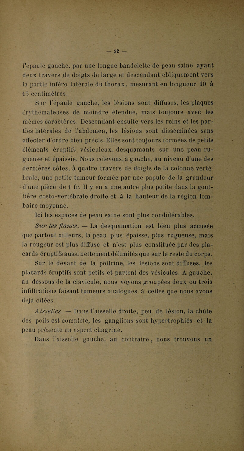 l’épaule gauche, par une longue bandelette de peau saine ayant deux travers de doigts de large et descendant obliquement vers la partie inféro latérale du thorax, mesurant en longueur 10 à 15 centimètres. Sur l’épaule gauche, les lésions sont diffuses, les plaques érythémateuses de moindre étendue, mais toujours avec les mêmes caractères. Descendant ensuite vers les reins et les par¬ ties latérales de l’abdomen, les lésions sont disséminées sans affecter d'ordre bien précis. Elles sont toujours formées de petits éléments éruptifs vésiculeux, desquamants sur une peau ru¬ gueuse et épaissie. Nous relevons, à gauche, au niveau d’une des dernières côtes, à quatre travers de doigts de la colonne verté¬ brale, une petite tumeur formée par une papule de la grandeur d’une pièce de 1 fr. Il y en a une autre plus petite dans la gout¬ tière costo-vertébrale droite et à la hauteur de la région lom- % baire moyenne. Ici les espaces de peau saine sont plus condidérables. Sur les flancs. — La desquamation est bien plus accusée que partout ailleurs, la peau plus épaisse, plus rugueuse, mais la rougeur est plus diffuse et n’est plus constituée par des pla¬ cards éruptifs aussi nettement délimités que sur le reste du corps. * . ' è > ■H Sur le devant de la poitrine, les lésions sont diffuses, les placards éruptifs sont petits et partent des vésicules. A gauche, au dessous de la clavicule, nous voyons groupées deux ou trois infiltrations faisant tumeurs analogues à celles que nous avons déjà citées. A iss elles. — Dans l’aisselle droite, peu de lésion, la chùte des poils est complète, les ganglions sont hypertrophiés et la peau présente un aspect chagriné. Dans l’aisselle gauche, au contraire, nous trouvons un