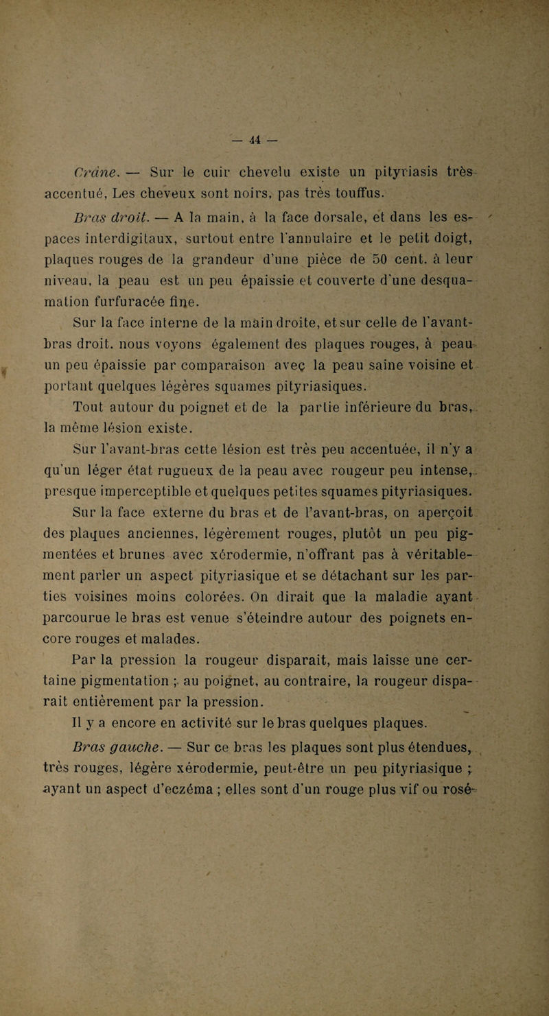 Crâne. — Sur le cuir chevelu existe un pityriasis très accentué, Les cheveux sont noirs, pas très touffus. Bras droit. — A la main, à la face dorsale, et clans les es¬ paces interdigitaux, surtout entre l'annulaire et le petit doigt, plaques rouges de la grandeur d’une pièce de 50 cent, à leur niveau, la peau est un peu épaissie et couverte d’une desqua¬ mation furfuracée fine. Sur la face interne de la main droite, et sur celle de l’avant- bras droit, nous voyons également des plaques rouges, à peau un peu épaissie par comparaison avec la peau saine voisine et portant quelques légères squames pityriasiques. Tout autour du poignet et de la partie inférieure du bras, la même lésion existe. Sur l’avant-bras cette lésion est très peu accentuée, il n’y a qu'un léger état rugueux de la peau avec rougeur peu intense,, presque imperceptible et quelques petites squames pityriasiques. Sur la face externe du bras et de l’avant-bras, on aperçoit des plaques anciennes, légèrement rouges, plutôt un peu pig¬ mentées et brunes avec xérodermie, n’offrant pas à véritable¬ ment parler un aspect pityriasique et se détachant sur les par¬ ties voisines moins colorées. On dirait que la maladie ayant parcourue le bras est venue s’éteindre autour des poignets en¬ core rouges et malades. Par la pression la rougeur disparait, mais laisse une cer- taine pigmentation ; au poignet, au contraire, la rougeur dispa¬ rait entièrement par la pression. Il y a encore en activité sur le bras quelques plaques. Bras gauche. — Sur ce bras les plaques sont plus étendues, très rouges, légère xérodermie, peut-être un peu pityriasique ; ayant un aspect d’eczéma ; elles sont d’un rouge plus vif ou rosé-