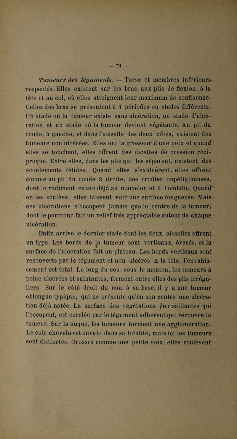 Tumeurs des téguments. — Torse et membres inférieurs respectés. Elles existent sur les bras, aux plis de flexion, à la tête et au col, où elles atteignent leur maximum de confluence. Celles des bras se présentent à 3 périodes ou stades différents. Un stade où la tumeur existe sans ulcération, un stade d’ulcé¬ ration et un stade où la tumeur devient végétante. Au pli du coude, à gauche, et dans l’aisselle des deux côtés, existent des tumeurs non ulcérées. Elles ont la grosseur d’une noix et quand' elles se touchent, elles offrent des facettes de pression réci¬ proque. Entre elles, dans les plis qui les séparent, existent des - écoulements fétides. Quand elles s’exulcèrent, elles offrent comme au pli du coude à droite, des croûtes impétigineuses, dont le rudiment existe déjà au mamelon et à l’ombilic. Quand' on les soulève, elles laissent voir une surface fongueuse. Mais - ces ulcérations n’occupent jamais que le centre de la tumeur, dont le pourtour fait un relief très appréciable autour de chaque ulcération. Enfin arrive le dernier slade dont les deux aisselles offrent un type. Les bords de la tumeur sont verticaux, évasés, et la- surface de l’ulcération fait un plateau. Les bords verticaux sont recouverts par le tégument et non ulcérés. A la tête, l’envahis-- sement est total. Le long du cou, sous le menton, les tumeurs à peine ulcérées et suintantes, forment entre elles des plis irrégu¬ liers. Sur le côté droit du cou, à sa base, il y a une tumeur oblongue typique, qui ne présente qu’en son centre une ulcéra¬ tion déjà notée. La surface des végétations peu saillantes qui l’occupent, est cerclée par le tégument adhérent qui recouvre la tumeur. Sur la nuque, les tumeurs forment une agglomération. Le cuir chevelu est envahi dans sa totalité, mais ici les tumeurs sont distinctes. Grosses comme une petite noix, elles soulèvent
