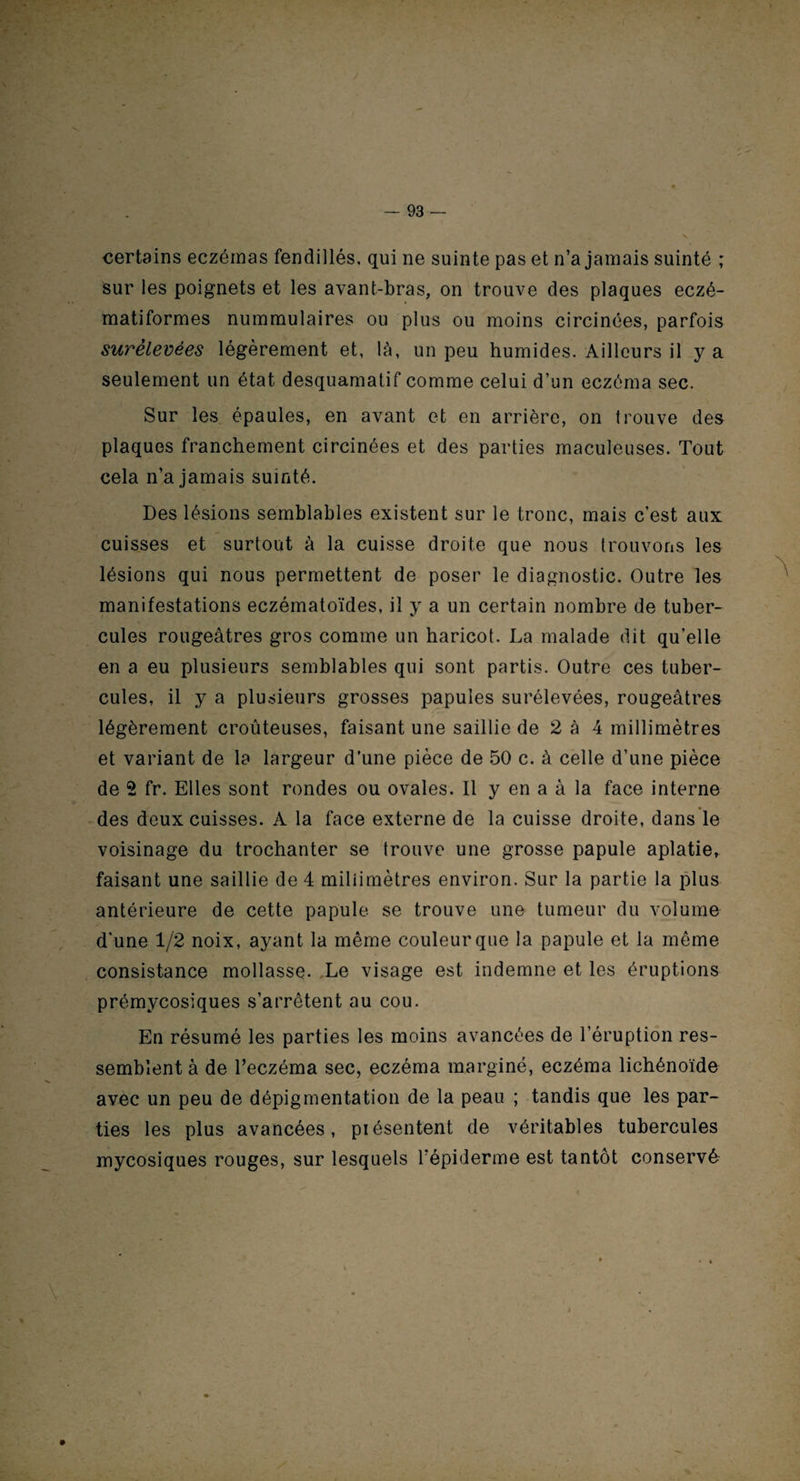certains eczémas fendillés, qui ne suinte pas et n’a jamais suinté ; sur les poignets et les avant-bras, on trouve des plaques eczé- matiformes nummulaires ou plus ou moins circinées, parfois surélevées légèrement et, là, un peu humides. Ailleurs il y a seulement un état desquamatif comme celui d’un eczéma sec. Sur les épaules, en avant et en arrière, on trouve des plaques franchement circinées et des parties maculeuses. Tout cela n’a jamais suinté. Des lésions semblables existent sur le tronc, mais c’est aux cuisses et surtout à la cuisse droite que nous trouvons les lésions qui nous permettent de poser le diagnostic. Outre les manifestations eczématoïdes, il y a un certain nombre de tuber¬ cules rougeâtres gros comme un haricot. La malade dit qu’elle en a eu plusieurs semblables qui sont partis. Outre ces tuber¬ cules, il y a plusieurs grosses papules surélevées, rougeâtres légèrement croûteuses, faisant une saillie de 2 à 4 millimètres et variant de la largeur d’une pièce de 50 c. à celle d’une pièce de 2 fr. Elles sont rondes ou ovales. Il y en a à la face interne des deux cuisses. A la face externe de la cuisse droite, dans le voisinage du trochanter se trouve une grosse papule aplatie, faisant une saillie de 4 miliimètres environ. Sur la partie la plus antérieure de cette papule se trouve une tumeur du volume d'une 1/2 noix, ayant la même couleur que la papule et la même consistance mollasse* Le visage est indemne et les éruptions prémycosiques s’arrêtent au cou. En résumé les parties les moins avancées de l’éruption res¬ semblent à de l’eczéma sec, eczéma marginé, eczéma lichénoïde avèc un peu de dépigmentation de la peau ; tandis que les par¬ ties les plus avancées, présentent de véritables tubercules mycosiques rouges, sur lesquels l’épiderme est tantôt conservé