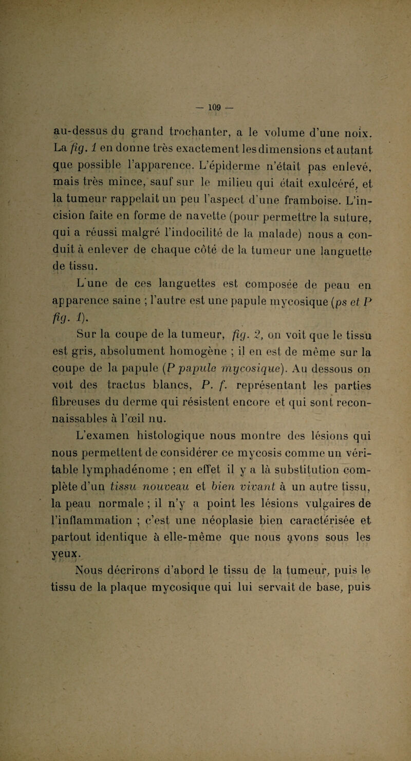 au-dessus du grand trochanter, a le volume d’une noix. La fig. 1 en donne très exactement les dimensions et autant que possible l’apparence. L’épiderme n’était pas enlevé, mais très mince, sauf sur le milieu qui était exulcéré, et la tumeur rappelait un peu l’aspect d’une framboise. L’in¬ cision faite en forme de navette (pour permettre la suture, qui a réussi malgré l’indocilité de la malade) nous a con¬ duit à enlever de chaque côté de la tumeur une languette de tissu. • v> i • . (. .f ji t L'une de ces languettes est composée de peau en apparence saine ; l’autre est une papule mycosique (ps et P fig- *). Sur la coupe de la tumeur, fig. 2, on voit que le tissu est gris, absolument homogène ; il en est de même sur la coupe de la papule (P papule mycosique). Au dessous on voit des tractus blancs, P. f. représentant les parties fibreuses du derme qui résistent encore et qui sont recon¬ naissables à l’œil nu. L’examen histologique nous montre des lésions qui nous permettent de considérer ce mycosis comme un véri¬ table lymphadénome ; en effet il y a là substitution com¬ plète d’un tissu nouveau et bien vivant à un autre tissu, la peau normale ; il n’y a point les lésions vulgaires de • ' ; l’inflammation ; c’est une néoplasie bien caractérisée et partout identique à elle-même que nous avons sous les yeux. Nous décrirons d’abord le tissu de la tumeur, puis le tissu de la plaque mycosique qui lui servait de base, puis