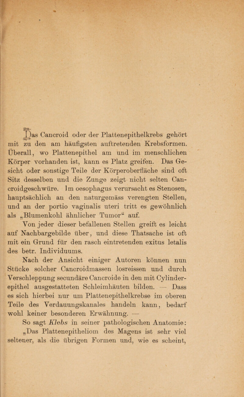 >as Cancroid oder der Plattenepithelkrebs gehört mit zu den am häufigsten auftretenden Krebsformen. Überall, wo Plattenepithel am und im menschlichen Körper vorhanden ist, kann es Platz greifen. Das Ge¬ sicht oder sonstige Teile der Körperoberfläche sind oft Sitz desselben und die Zunge zeigt nicht selten Can- croidgeschwiire. Im Oesophagus verursacht es Stenosen, hauptsächlich an den naturgemäss verengten Stellen, und an der portio vaginalis uteri tritt es gewöhnlich als „Blumenkohl ähnlicher Tumor“ auf. Von jeder dieser befallenen Stellen greift es leicht auf Nachbargebilde über, und diese Thatsache ist oft mit ein Grund für den rasch eintretenden exitus letalis des betr. Individuums. Nach der Ansicht einiger Autoren können nun Stücke solcher Cancroidmassen losreissen und durch Verschleppung secundäre Cancroide in den mit Cylinder- epithel ausgestatteten Schleimhäuten bilden. — Dass es sich hierbei nur um Plattenepithelkrebse im oberen Teile des Verdauungskanales handeln kann, bedarf wohl keiner besonderen Erwähnung. — So sagt Klebs in seiner pathologischen Anatomie: „Das Plattenepitheliom des Magens ist sehr viel seltener, als die übrigen Formen und, wie es scheint,