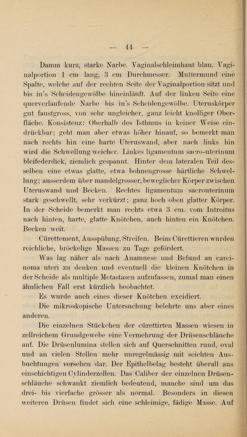 Damm kurz, starke Narbe. Vaginalschleimhaut blau. Vagi¬ nalportion 1 cm lang, 3 cm Durchmesser. Muttermund eine Spalte, welche auf der rechten Seite der Vaginalportion sitzt und bis in’s Scheidengewölbe hineinläuft. Auf der linken Seite eine querverlaufende Narbe bis in’s Scheidengewölbe. Uteruskörper gut faustgross, von sehr ungleicher, ganz leicht knolliger Ober¬ fläche. Konsistenz: Oberhalb des Isthmus in keiner Weise ein¬ drück bar; geht man aber etwas höher hinauf, so bemerkt man nach rechts hin eine harte Uteruswand, aber nach links hin wird die Schwellung weicher. Linkes ligamentum sacro-uterinum bleifederdick, ziemlich gespannt. Hinter dem lateralen Teil des¬ selben eine etwas glatte, etwa bohnengrosse härtliche Schwel¬ lung; ausserdem über mandelgrosser, beweglicher Körper zwischen Uterus wand und Becken. Rechtes ligamentum sacrouterinum stark geschwellt, sehr verkürzt; ganz hoch oben glatter Körper. In der Scheide bemerkt man rechts etwa 3 cm. vom Introitus nach hinten, harte, glatte Knötchen, auch hinten ein Knötchen. Becken weit. Ctirettement, Ausspülung, Streifen. Beim Cürettieren wurden reichliche, bröckelige Massen zu Tage gefördert. Was lag näher als nach Anamnese und Befund an Carci¬ noma uteri zu denken und eventuell die kleinen Knötchen in der Scheide als multiple Metastasen aufzufassen, zumal man einen ähnlichen Fall erst kürzlich beobachtet. Es wurde auch eines dieser Knötchen excidiert. Die mikroskopische Untersuchung belehrte uns aber eines anderen. Die einzelnen Stückchen der cürettirten Massen wiesen in zellreichem Grundgewebe eine Vermehrung der Drüsenschläuche auf. Die Drüsenlumina stellen sich auf Querschnitten rund, oval und an vielen Stellen mehr unregelmässig mit seichten Aus¬ buchtungen versehen dar. Der Epithelbelag besteht überall aus einschichtigen Cvlinderzellen. Das Caliber der einzelnen Drüsen- Schläuche schwankt ziemlich bedeutend, manche sind um das drei- bis vierfache grösser als normal. Besonders in diesen weiteren Drüsen findet sich eine schleimige, fädige Masse. Auf