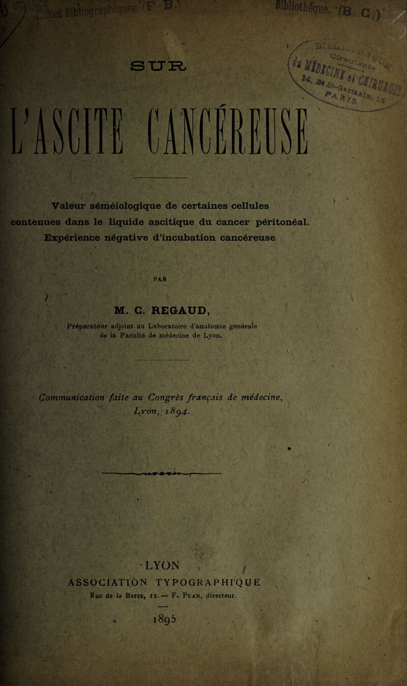 , •k; (T? ■ B-) ■ wè- YB c \ X* ^ \ * * « t.» ’ r/? UItJJ Valeur séméiologique de certaines cellules contenues dans le liquide ascitique du cancer péritonéal. Expérience négative d’incubation cancéreuse PAR M. C. REGAUD, Préparateur adjoint au Laboratoire d’anatomie générale de la Faculté de médecine de Lyon. Communication faite au Congrès français de médecine, Lyon, iSg4. & ’.i mi LYON ASSOCIATION TYPOGRAPHIQUE Rue de la Barre, 12.— F. Plan, directeur. m