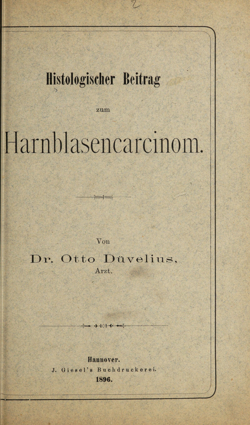 zum Harnblasencarcinom. Von D i*. 011 o D tl v e 1 i u s, Arzt. Hamiover. J. Giesel’s Buchdruck erei. 1896.