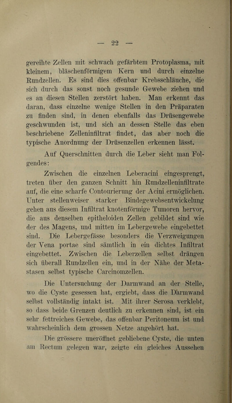 gereihte Zellen mit schwach gefärbtem Protoplasma, mit kleinem, bläschenförmigem Kern und durch einzelne Rundzellen. Es sind dies offenbar Krebsschläuche, die sich durch das sonst noch gesunde Gewebe ziehen und es an diesen Stellen zerstört haben. Man erkennt das daran, dass einzelne wenige Stellen in den Präparaten zu finden sind, in denen ebenfalls das Drüsengewebe geschwunden ist, und sich an dessen Stelle das eben beschriebene Zelleninfiltrat findet, das aber noch die typische Anordnung der Drüsenzellen erkennen lässt. Auf Querschnitten durch die Leber sieht man Fol¬ gendes : Zwischen die einzelnen Leberacini eingesprengt, treten über den ganzen Schnitt hin Kundzelleninfiltrate auf, die eine scharfe Contourierung der Acini ermöglichen. Unter stellen weiser starker Bindege websentwickelung gehen aus diesem Infiltrat knotenförmige Tumoren hervor, die aus denselben epitheloiden Zellen gebildet sind wie der des Magens, und mitten im Lebergewebe eingebettet sind. Die Lebergefässe besonders die Verzweigungen der Vena portae sind sämtlich in ein dichtes Infiltrat eingebettet. Zwischen die Leberzellen selbst drängen sich überall Kundzellen ein, und in der Nähe der Meta¬ stasen selbst typische Carcinomzellen. Die Untersuchung der Darmwand an der Stelle, wo die Cyste gesessen hat, ergiebt, dass die Därmwand selbst vollständig intakt ist. Mit ihrer Serosa verklebt, so dass beide Grenzen deutlich zu erkennen sind, ist ein sehr fettreiches Gewebe, das offenbar Peritoneum ist und wahrscheinlich dem grossen Netze angehört hat. Die grössere uneröffnet gebliebene Cyste, die unten am Rectum gelegen war, zeigte ein gleiches Aussehen
