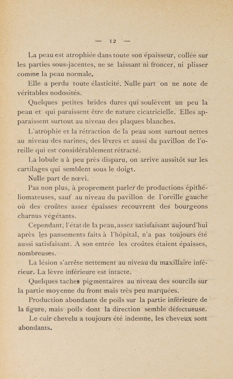 La peau est atrophiée dans toute son épaisseur, collée sur les parties sous-jacentes, ne se laissant ni froncer, ni plisser comme la peau normale. Elle a perdu toute élasticité. Nulle part on ne note de véritables nodosités. Quelques petites brides dures qui soulèvent un peu la peau et qui paraissent être de nature cicatricielle. Elles ap¬ paraissent surtout au niveau des plaques blanches. L’atrophie et la rétraction de la peau sont surtout nettes au niveau des narines, des lèvres et aussi du pavillon de l’o¬ reille qui est considérablement rétracté. La lobule a à peu près disparu, on arrive aussitôt sur les cartilages qui semblent sous le doigt. Nulle part de nœvi. Pas non plus, à proprement parler de productions épithé- liomateuses, sauf au niveau du pavillon de l’oreille gauche où des croûtes assez épaisses recouvrent des bourgeons charnus végétants. Cependant , l’état de la peau, assez satisfaisant aujourd’hui après les pansements faits à l’hôpital, n’a pas toujours été aussi satisfaisant. A son entrée les croûtes étaient épaisses, nombreuses. La lésion s’arrête nettement au niveau du maxillaire infé¬ rieur. La lèvre inférieure est intacte. Quelques taches pigmentaires au niveau des sourcils sur la partie moyenne du front mais très peu marquées. Production abondante de poils sur la partie inférieure de la figure, mais poils dont la direction semble défectueuse. Le cuir chevelu a toujours été indemne, les cheveux sont abondants.