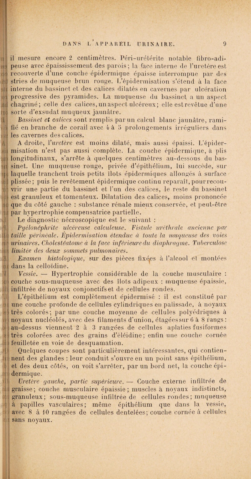 il : fl 3 è lib:: 9{t) 1)1 ,ii f fie a » ) K.'! À ii ¥i 3 il! m id m n ;:»J| A1 II ■■ira 4 ifljj M )L lit i J 11 ■3 I1 aI 4 j H 1 j > ■ i: M il i|| fl 5 1 il mesure encore 2 centimètres. Péri-urétérite notable fibro-adi- peuse avec épaississement des parois; la face interne de l’uretère est recouverte d’une couche épidermique épaisse interrompue par des stries de muqueuse brun rouge. L’épidermisation s’étend à Ja face interne du bassinet et des calices dilatés en cavernes par ulcération progressive des pyramides. La muqueuse du bassinet, a un aspect chagriné; celle des calices, un aspect ulcéreux; elle estrevêtue d’nne sorte d’exsudat muqueux jaunâtre. Bassinet et calices sont remplis par un calcul blanc jaunâtre, rami¬ fié en branche de corail avec 4 à 5 prolongements irréguliers dans les cavernes des calices. A droite, l’uretère est moins dilaté, mais aussi épaissi. L’épider¬ misation n’est pas aussi complète. La couche épidermique, à plis longitudinaux, s’arrête à quelques centimètres au-dessous du bas¬ sinet. Une muqueuse rouge, privée d’épithélium, lui succède, sur laquelle tranchent trois petits îlots épidermiques allongés à surface plissée: puis le revêtement épidermique continu reparaît, pourrecou- vrir une partie du bassinet et l’un des calices, le reste du bassinet est granuleux ettomenteux. Dilatation des calices, moins prononcée que du côté gauche : substance rénale mieux conservée, et peut-être par hypertrophie compensatrice partielle. Le diagnostic nécroscopique est le suivant : Pyélonéphrite ulcéreuse calculeuse. Fistule uréthrale ancienne par taille périnéale. Epidermisation étendue à toute la muqueuse des voies urinaires. Cholestéatome à la face inférieure du diaphragme. Tuberculose limitée des deux sommets pulmonaires. Examen histologique, sur des pièces fixées à l’alcool et montées dans la celloïdine. Vessie. — Hypertrophie considérable de la couche musculaire : couche sous-muqueuse avec des îlots adipeux : muqueuse épaissie, infiltrée de noyaux conjonctifs et de cellules rondes. L’épithélium est complètement épidermisé : il est constitué par une couche profonde de cellules cylindriques en palissade, à noyaux très colorés; par une couche moyenne de cellules polyédriques à noyaux nucléolés, avec des filaments d’union, étagées sur 6 à 8 rangs : au-dessus viennent 2 à 3 rangées de cellules aplaties fusiformes très colorées avec des grains d’éléidine; enfin une couche cornée feuilletée en voie de desquamation. Quelques coupes sont particulièrement intéressantes, qui contien¬ nent des glandes : leur conduit s’ouvre en un point sans épithélium, et des deux côtés, on voit s’arrêter, par un bord net, la couche épi¬ dermique. Uretère gauche, partie supérieure. — Couche externe infiltrée de graisse; couche musculaire épaissie ; muscles à noyaux indistincts, granuleux; sous-muqueuse infiltrée de cellules rondes ; muqueuse à papilles vasculaires; même épithélium que dans la vessie, avec 8 à 10 rangées de cellules dentelées; couche cornée à cellules sans noyaux.