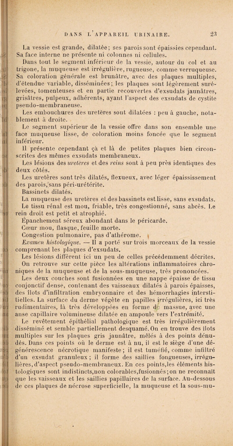 m 'fit jji ai CW . , :|ô m:; à: à; :iiî é ] ftp! Lit) NI La vessie est grande, dilatée; ses parois sont épaissies cependant. Sa face interne ne présente ni colonnes ni cellules. Dans tout le segment inférieur de la vessie, autour du col et au trigone, la muqueuse est irrégulière, rugueuse, comme verruqueuse. Sa coloration générale est brunâtre, avec des plaques multiples, d’étendue variable, disséminées; les plaques sont légèrement suré¬ levées, tomenteuses et en partie recouvertes d’exsudats jaunâtres, grisâtres, pulpeux, adhérents, ayant l’aspect des exsudats de cystite pseudo-membraneuse. Les embouchures des uretères sont dilatées : peu à gauche, nota¬ blement à droite. Le segment supérieur de la vessie offre dans son ensemble une face muqueuse lisse, de coloration moins foncée que le segment inférieur. 11 présente cependant çà et là de petites plaques bien circon¬ scrites des mêmes exsudats membraneux. Les lésions des uretères et des reins sont à peu près identiques des deux côtés. Les uretères sont très dilatés, flexueux, avec léger épaississement des parois,'sans péri-urétérite. Bassinets dilatés. La muqueuse des uretères et des bassinets est lisse, sans exsudats. Le tissu rénal est mou, friable, très congestionné, sans abcès. Le rein droit est petit et atrophié. Épanchement séreux abondant dans le péricarde. Cœur mou, flasque, feuille morte. Congestion pulmonaire, pas d’athérome. Examen histologique. — Il a porté sur trois morceaux de la vessie comprenant les plaques d’exsudats. Les lésions diffèrent ici un peu de celles précédemment décrites. On retrouve sur cette pièce les altérations inflammatoires chro¬ niques de la muqueuse et de la sous-muqueuse, très prononcées. Les deux couches sont fusionnées en une nappe épaisse de tissu conjonctif dense, contenant des vaisseaux dilatés à parois épaisses, des îlots d’infiltration embryonnaire et des hémorrhagies intersti¬ tielles. La surface du derme végète en papilles irrégulières, ici très rudimentaires, là très développées en forme do massue, avec une anse capillaire volumineuse dilatée en ampoule vers l’extrémité. Le revêtement épithélial pathologique est très irrégulièrement disséminé et semble partiellement desquamé. On en trouve des îlots multiples sur les plaques gris jaunâtre, mêlés à des points dénu¬ dés. Dans ces points où le derme est à nu, il est le siège d’une dé¬ générescence nécrotique manifeste ; il est tuméfié, comme infiltré d’un exsudât granuleux ; il forme des saillies fongueuses, irrégu¬ lières, d’aspect pseudo-membraneux. En ces points,les éléments his¬ tologiques sont indistincts,non colorables,fusionnés ; on ne reconnaît que les vaisseaux et les saillies papillaires de la surface. Au-dessous de ces plaques de nécrose superficielle, la muqueuse et la sous-mu-