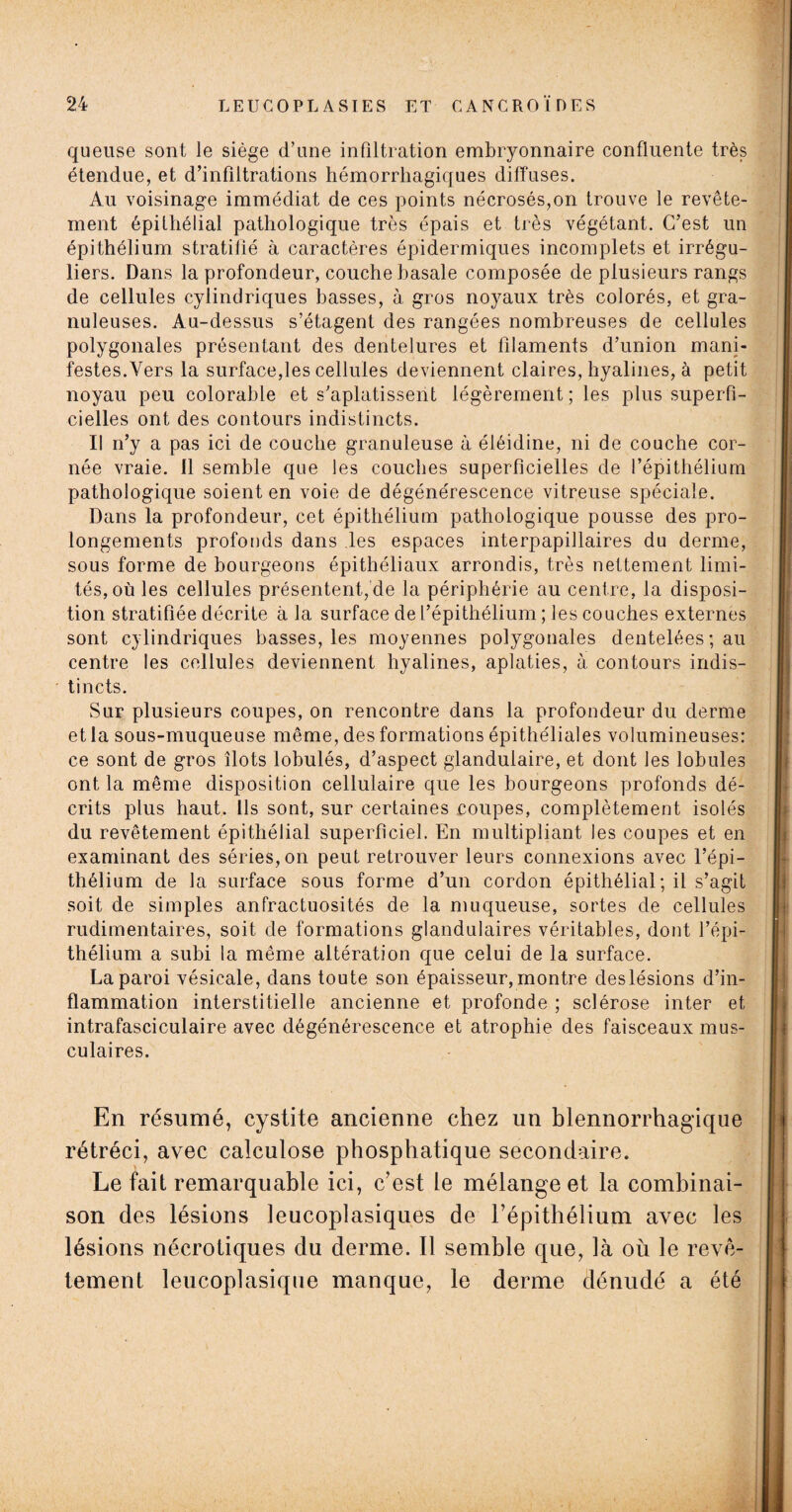 queuse sont le siège d’une infiltration embryonnaire confluente très étendue, et d’infiltrations hémorrhagiques diffuses. Au voisinage immédiat de ces points nécrosés,on trouve le revête¬ ment épithélial pathologique très épais et très végétant. C’est un épithélium stratifié à caractères épidermiques incomplets et irrégu¬ liers. Dans la profondeur, couche basale composée de plusieurs rangs de cellules cylindriques basses, à gros noyaux très colorés, et gra¬ nuleuses. Au-dessus s’étagent des rangées nombreuses de cellules polygonales présentant des dentelures et filaments d’union mani¬ festes. Vers la surface,les cellules deviennent claires, hyalines, à petit noyau peu colorable et s’aplatissent légèrement ; les plus superfi¬ cielles ont des contours indistincts. Il n’y a pas ici de couche granuleuse à éléidine, ni de couche cor¬ née vraie. 11 semble que les couches superficielles de l’épithélium pathologique soient en voie de dégénérescence vitreuse spéciale. Dans la profondeur, cet épithélium pathologique pousse des pro¬ longements profonds dans les espaces interpapillaires du derme, sous forme de bourgeons épithéliaux arrondis, très nettement limi¬ tés, où les cellules présentent, de la périphérie au centre, la disposi¬ tion stratifiée décrite à la surface de l’épithélium ; les couches externes sont cylindriques basses, les moyennes polygonales dentelées; au centre les cellules deviennent hyalines, aplaties, à contours indis¬ tincts. Sur plusieurs coupes, on rencontre dans la profondeur du derme et la sous-muqueuse même, des formations épithéliales volumineuses: ce sont de gros îlots lobulés, d’aspect glandulaire, et dont les lobules ont la même disposition cellulaire que les bourgeons profonds dé¬ crits plus haut. Ils sont, sur certaines coupes, complètement isolés du revêtement épithélial superficiel. En multipliant les coupes et en examinant des séries, on peut retrouver leurs connexions avec l’épi¬ thélium de la surface sous forme d’un cordon épithélial; il s’agit soit de simples anfractuosités de la muqueuse, sortes de cellules rudimentaires, soit de formations glandulaires véritables, dont l’épi¬ thélium a subi la même altération que celui de la surface. La paroi vésicale, dans toute son épaisseur, montre deslésions d’in¬ flammation interstitielle ancienne et profonde ; sclérose inter et intrafasciculaire avec dégénérescence et atrophie des faisceaux mus¬ culaires. En résumé, cystite ancienne chez un blennorrhagique rétréci, avec calculose phosphatique secondaire. Le fait remarquable ici, c’est le mélange et la combinai¬ son des lésions leucoplasiques de l’épithélium avec les lésions nécrotiques du derme. Il semble que, là où le revê¬ tement leucoplasique manque, le derme dénudé a été