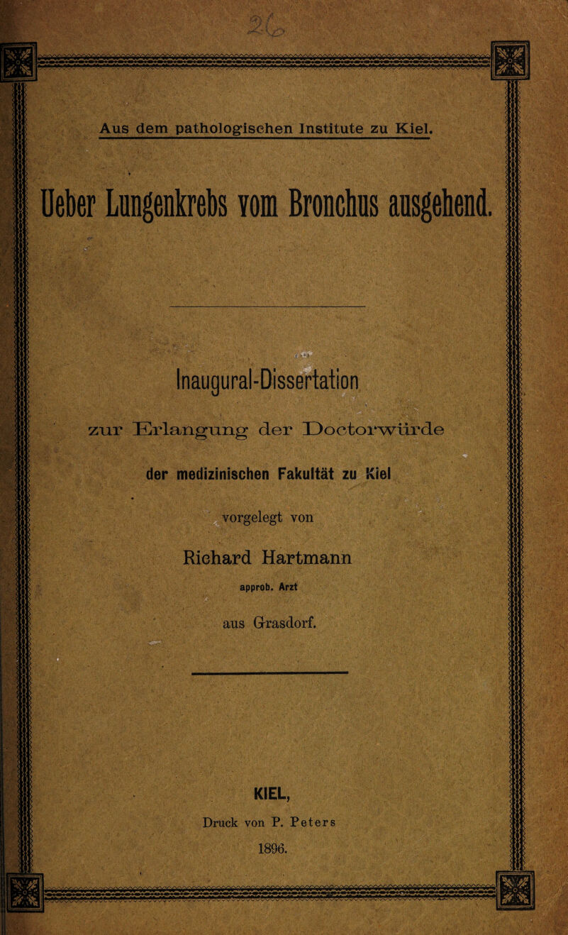 zur Erlangung der üootorwiirde der medizinischen Fakultät zu vorgelegt von Riehard Hartmann approb. Arzt aus Grasdorf. Druck von P. Peters vwwwv^vvv*Ä^wWWvvvvWv*