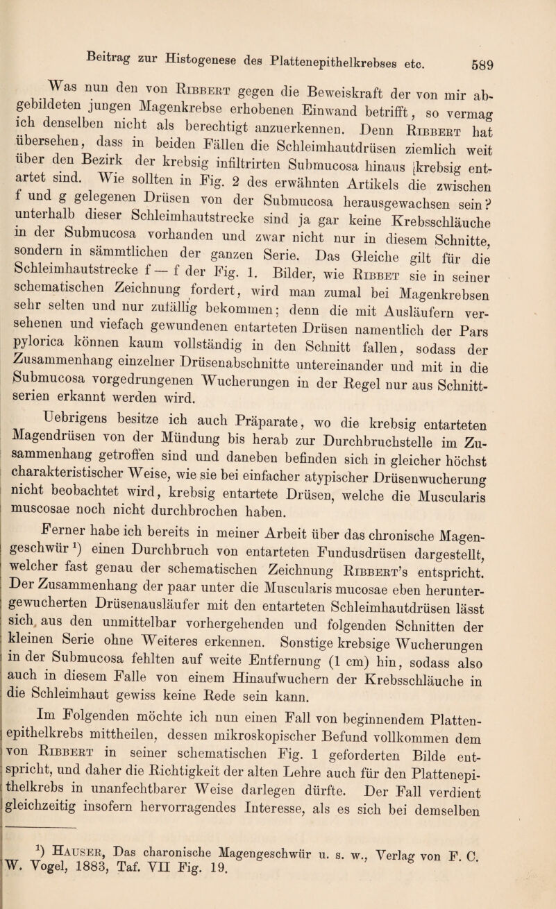 Was nun den von Ribbebt gegen die Beweiskraft der von mir ab- gebildeten jungen Magenkrebse erhobenen Binwand betrifft, so vermag ich denselben mcht als berechtigt anzuerkennen. Denn Ribbebt hat ubersehen, dass m beiden Fallen die Schleimhautdriisen ziemlich weit uber den Bezirk der krebsig infiltrirten Submucosa kinaus jkrebsig ent- artet smd. Wie sollten in Fig. 2 des erwahnten Artikels die zwischen und g gelegenen Drusen von der Submucosa herausgewachsen sein? unterhalb dieser Schleimhautstrecke sind ja gar keine Krebsschlauche m der Submucosa vorhanden und zwar nickt nur in diesem Schnitte sondern in sammtlicken der ganzen Serie. Das Gleiclie gilt fur die Schleimhautstrecke f- f der Fig. 1. Bilder, wie Ribbet sie in seiner schematischen Zeichnung fordert, wird man zumal bei Magenkrebsen sebr selten und nur zulallig bekommen; denn die mit Auslaufern ver- sehenen und viefach gewundenen entarteten Drusen namentlicb der Pars pylonca konnen kaum vollstandig in den Schnitt fallen, sodass der Zusammenhang einzelner Driisenabschnitte untereinander und mit in die Submucosa vorgedrungenen Wucherungen in der Regel nur aus Schnitt- serien erkannt werden wird. Uebngens besitze ich auch Praparate, wo die krebsig entarteten Magendriisen von der Miindung bis herab zur Durchbruchstelle irn Zu¬ sammenhang getroffen sind und daneben befinden sicb in gleicher hochst cbarakteristischer Weise, wie sie bei einfacher atypiscber Driisenwucherung mcht beobachtet wird, krebsig entartete Drusen, welche die Muscularis muscosae noch nicbt durcbbrocben baben. Fernei habe ich bereits in meiner Arbeit uber das chronische Magen- geschwiir 2) einen Durchbruch von entarteten Fundusdriisen dargestellt, welcher fast genau der schematischen Zeichnung Ribbert’s entspricht. Dei Zusammenhang der paar unter die Muscularis mucosae eben herunter- i gewucherten Driisenauslaufer mit den entarteten Schleimhautdrusen lasst : sich4 aus den unmittelbar vorhergehenden und folgenden Schnitten der : kleinen Serie ohne Weiteres erkennen. Sonstige krebsige Wucherungen i in der Submucosa fehlten auf weite Entfernung (1 cm) bin, sodass also auch in diesem Falle von einem Hinaufwuchern der Krebsschlauche in die Schleimhaut gewiss keine Rede sein kann. Im Folgenden mochte ich nun einen Fall von beginnendem Platten- epithelkrebs mittheilen, dessen mikroskopischer Befund vollkommen dem von Ribbebt in seiner schematischen Fig. 1 geforderten Bilde ent¬ spricht, und daher die Richtigkeit der alten Lehre auch fur den Plattenepi- thelkrebs in unanfechtbarer Weise darlegen diirfte. Der Fall verdient gleichzeitig insofern hervorragendes Interesse, als es sich bei demselben 3) Hausek, Das charonische Magengeschwiir u. s. w., Yerlas’ von F 0 W. Yogel, 1883, Taf. YII Fig. 19.