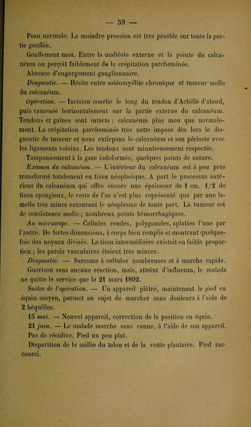 Peau normale. La moindre pression est très pénible sur toute la par¬ tie gonflée. Gonflement mou. Entre la malléole externe et la pointe du calca¬ néum on perçoit faiblement de la crépitation parcheminée. Absence d’engorgement ganglionnaire. Diagnostic. — Hésite entre ostéomyélite chronique et tumeur molle du calcanéum. Opération. — Incision courbe le long du tendon d’Achille d’abord, puis ramenée horizontalement sur la partie externe du calcanéum. Tendons et gaines sont intacts ; calcanéum plus mou que normale¬ ment. La crépitation parcheminée très nette impose dès lors le dia¬ gnostic de tumeur et nous extirpons le calcanéum et son périoste avec les ligaments voisins. Les tendons sont minutieusement respectés. Tamponnement à la gaze iodoformée, quelques points de suture. Examen du calcanéum. — L'intérieur du calcanéum est à peu près transformé totalement en tissu néoplasique. A part le processus anté¬ rieur du calcanéum qui offre encore une épaisseur de 1 cm. 1/2 de tissu spongieux, le reste de l’os n’est plus représenté que par une la¬ melle très mince entourant le néoplasme de toute part. La tumeur est de consistance molle; nombreux points hémorrhagiques. Au microscope. — Cellules rondes, polygonales, aplaties l’une par l’autre. De fortes dimensions, à corps bien remplis et montrant quelque¬ fois des noyaux divisés. Le tissu intermédiaire existait en faible propor¬ tion ; les parois vasculaires étaient très minces. Diagnostic. — Sarcome à cellules nombreuses et à marche rapide. Guérison sans aucune réaction, mais, atteint d’influenza, le malade ne quitte le service que le 21 mars 1892. Suites de l’opération. — Un appareil plâtré, maintenant le pied en équin moyen, permet au sujet de marcher sans douleurs à l’aide de 2 béquilles. 15 mai. — Nouvel appareil, correction de la position en équin. 21 juin. — Le malade marche sans canne, à l’aide de son appareil. Pas de récidive. Pied un peu plat. Disparition de la saillie du talon et de la voûte plantaire. Pied rac¬ courci.