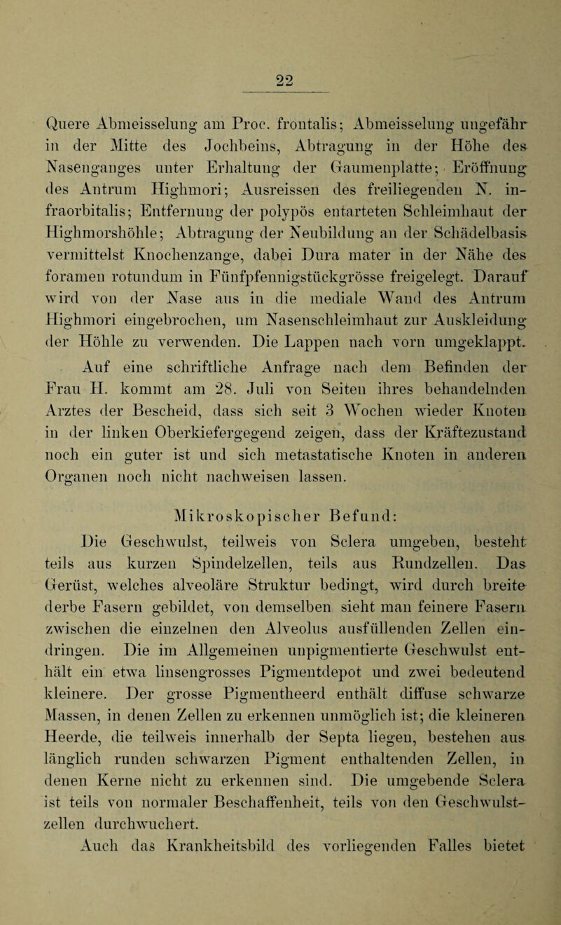 Quere Abmeisselung am Proe. fröntalis; Abmeisselung ungefähr in der Mitte des Jochbeins, Abtragung in der Höhe des Nasenganges unter Erhaltung der Gaumenplatte; Eröffnung des Antrum Highmori; Ausreissen des freiliegenden N. in- fraorbitalis; Entfernung der polypös entarteten Schleimhaut der Highmorshöhle; Abtragung der Neubildung an der Schädelbasis vermittelst Knochenzange, dabei Dura mater in der Nähe des foramen rotundum in Fünfpfennigstückgrösse freigelegt. Darauf wird von der Nase aus in die mediale Wand des Antrum Highmori eingebrochen, um Nasenschleimhaut zur Auskleidung der Höhle zu verwenden. Die Lappen nach vorn umgeklappt. Auf eine schriftliche Anfrage nach dem Befinden der Frau H. kommt am 28. Juli von Seiten ihres behandelnden Arztes der Bescheid, dass sich seit 3 Wochen wieder Knoten in der linken Oberkiefergegend zeigen, dass der Kräftezustand noch ein guter ist und sich metastatische Knoten in anderen Organen noch nicht nach weisen lassen. Mikroskopischer Befund: Die Geschwulst, teilweis von Sclera umgeben, besteht teils aus kurzen Spindelzellen, teils aus Rundzellen. Das Gerüst, welches alveoläre Struktur bedingt, wird durch breite derbe Fasern gebildet, von demselben sieht man feinere Fasern zwischen die einzelnen den Alveolus ausfüllenden Zellen ein- dringen. Die im Allgemeinen unpigmentierte Geschwulst ent¬ hält ein etwa linsengrosses Pigmentdepot und zwei bedeutend kleinere. Der grosse Pigmentheerd enthält diffuse schwarze Massen, in denen Zellen zu erkennen unmöglich ist; die kleineren Heerde, die teilweis innerhalb der Septa liegen, bestehen aus länglich runden schwarzen Pigment enthaltenden Zellen, in denen Kerne nicht zu erkennen sind. Die umgebende Sclera ist teils von normaler Beschaffenheit, teils von den Geschwulst¬ zellen durchwuchert. Auch das Krankheitsbild des vorliegenden Falles bietet