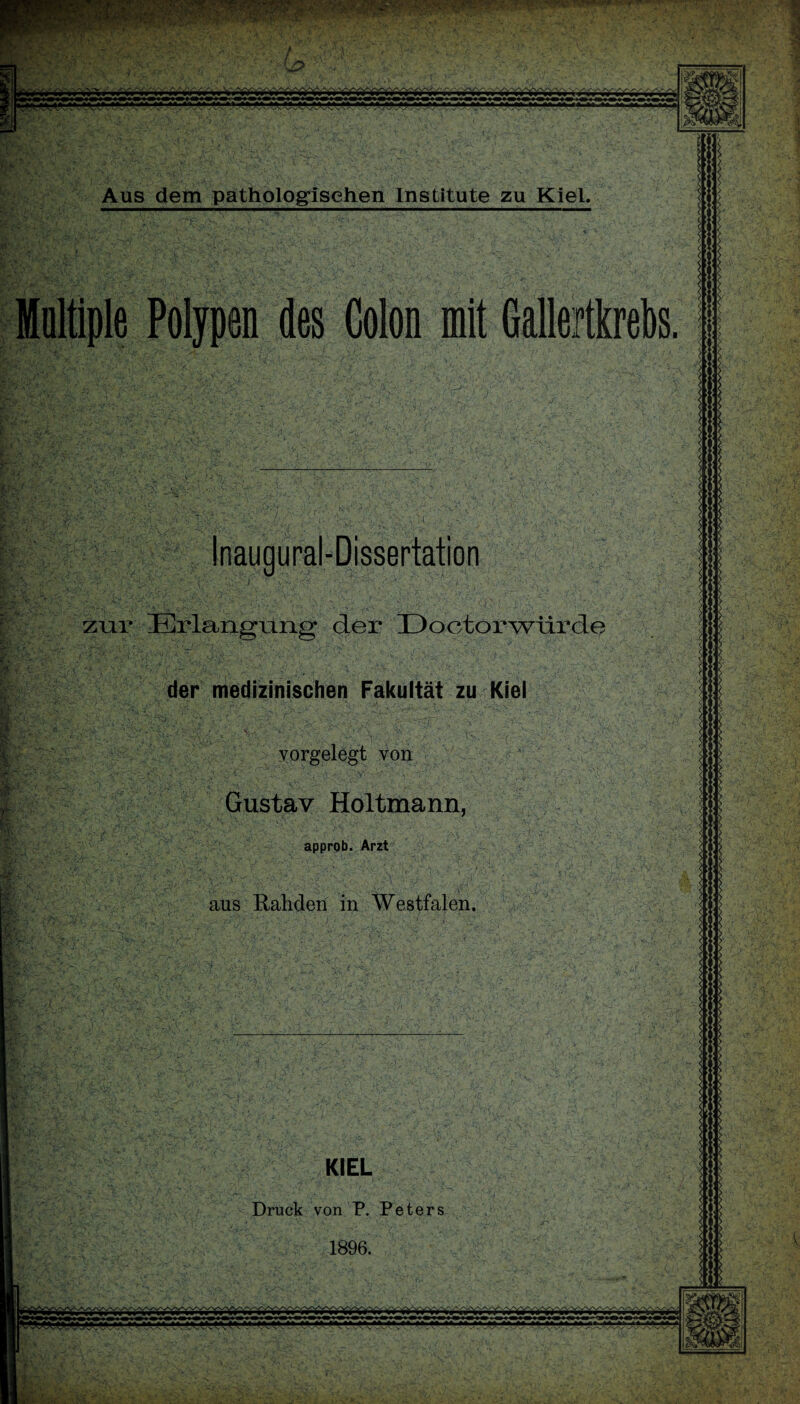 W .. w-m jjrvrvrwv* -. .'.v.r.v.v^. «r» »« — «« i«OiO» Mitfcjfcjfci 'WWVVVvWVVVyWWWVV Aus dem pathologischen Institute zu KieL Inaugural-Dissertation zur 7-'f'v ;:\- Erlangnng der Doctorwürde der medizinischen Fakultät zu Kiel - A “sj- y ,/t> k :.*'1-Z.d ^ ,.*■ N ' ■•.. \ • •■»*.■  '  ■'V'•‘V f -i ' .. \sS >- ,\J •, : - -' '\* 1 ^ V Vv * ‘ ’ ' .• • ' vorgelegt von Gustav Holtmann, approb. Arzt aus Rahden in Westfalen.