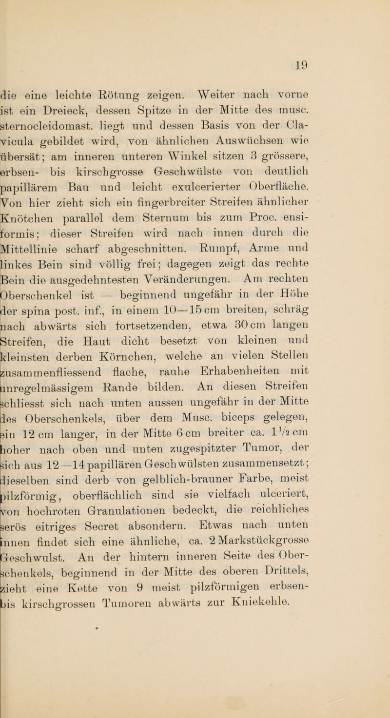 die eine leichte Rötung zeigen. Weiter nach vorne ist ein Dreieck, dessen Spitze in der Mitte des musc. sternocleidornast. liegt und dessen Basis von der Ola- vicula gebildet wird, von ähnlichen Auswüchsen wie übersät; am inneren unteren Winkel sitzen 3 grössere, erbsen- bis kirschgrosse Geschwülste von deutlich papillärem Bau und leicht exulcerierter Oberfläche. Von hier zieht sich ein fingerbreiter Streifen ähnlicher Knötchen parallel dem Sternum bis zum Proc. ensi- formis; dieser Streifen wird nach innen durch die Mittellinie scharf abgeschnitten. Rumpf, Arme und linkes Bein sind völlig frei; dagegen zeigt das rechte Bein die ausgedehntesten Veränderungen. Am rechten Oberschenkel ist — beginnend ungefähr in der Höhe der spina post, inf., in einem 10—15 cm breiten, schräg nach abwärts sich fortsetzenden, etwa 30 cm langen Streifen, die Haut dicht besetzt von kleinen und kleinsten derben Körnchen, welche an vielen Stellen zusammenfliessend flache, rauhe Erhabenheiten mit unregelmässigem Rande bilden. An diesen Streifen schliesst sich nach unten aussen ungefähr in der Mitte des Oberschenkels, über dem Musc. biceps gelegen, ein 12 cm langer, in der Mitte 6 cm breiter ca. lV2cm hoher nach oben und unten zugespitzter Tumor, der sich aus 12 —14 papillären Geschwülsten zusammensetzt; dieselben sind derb von gelblich-brauner Farbe, meist pilzförmig, oberflächlich sind sie vielfach ulceriert, von hochroten Granulationen bedeckt, die reichliches serös eitriges Secret absondern. Etwas nach unten innen findet sich eine ähnliche, ca. 2 Markstückgrosse Geschwulst. An der hintern inneren Seite des Ober¬ schenkels, beginnend in der Mitte des oberen Drittels, zieht eine Kette von 9 meist pilzförmigen erbsen- bis kirschgrossen Tumoren abwärts zur Kniekehle.