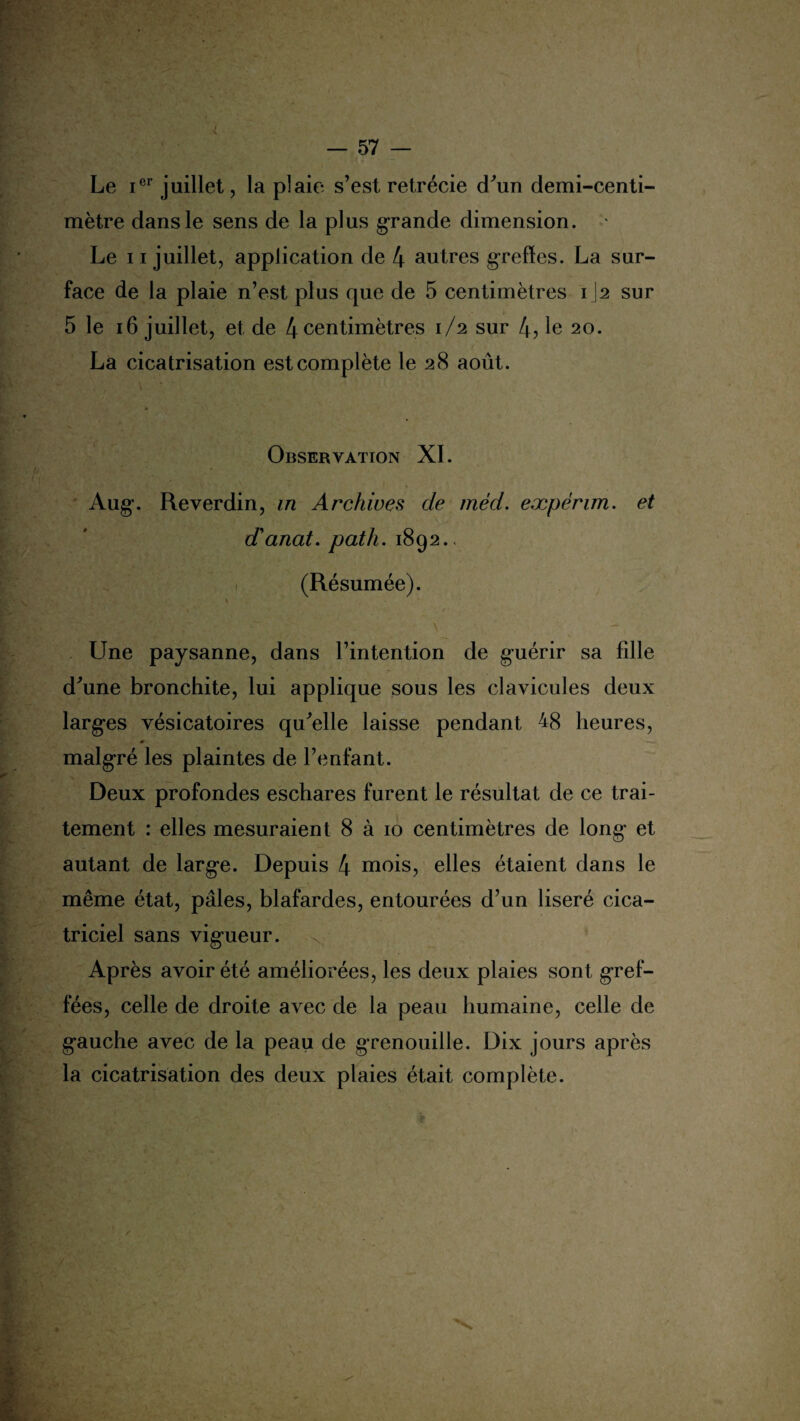 Le ier juillet, la plaie s’est rétrécie cTun demi-centi¬ mètre dans le sens de la plus grande dimension. ' Le 11 juillet, application de 4 autres greffes. La sur¬ face de la plaie n’est plus que de 5 centimètres 1J2 sur 5 le 16 juillet, et de 4 centimètres 1/2 sur 4? le 20. La cicatrisation est complète le 28 août. Observation XI. Aug\ Reverdin, in Archives de méd. eæpérim. et d'anat. path. 1892.. (Résumée). * Une paysanne, dans l’intention de guérir sa fille d'une bronchite, lui applique sous les clavicules deux largues vésicatoires qu'elle laisse pendant 48 heures, ♦ —- malgré les plaintes de l’enfant. Deux profondes eschares furent le résultat de ce trai¬ tement : elles mesuraient 8 à 10 centimètres de long* et autant de larg-e. Depuis 4 mois, elles étaient dans le même état, pâles, blafardes, entourées d’un liseré cica¬ triciel sans vig’ueur. Après avoir été améliorées, les deux plaies sont gref¬ fées, celle de droite avec de la peau humaine, celle de g-auche avec de la peau de grenouille. Dix jours après la cicatrisation des deux plaies était complète.