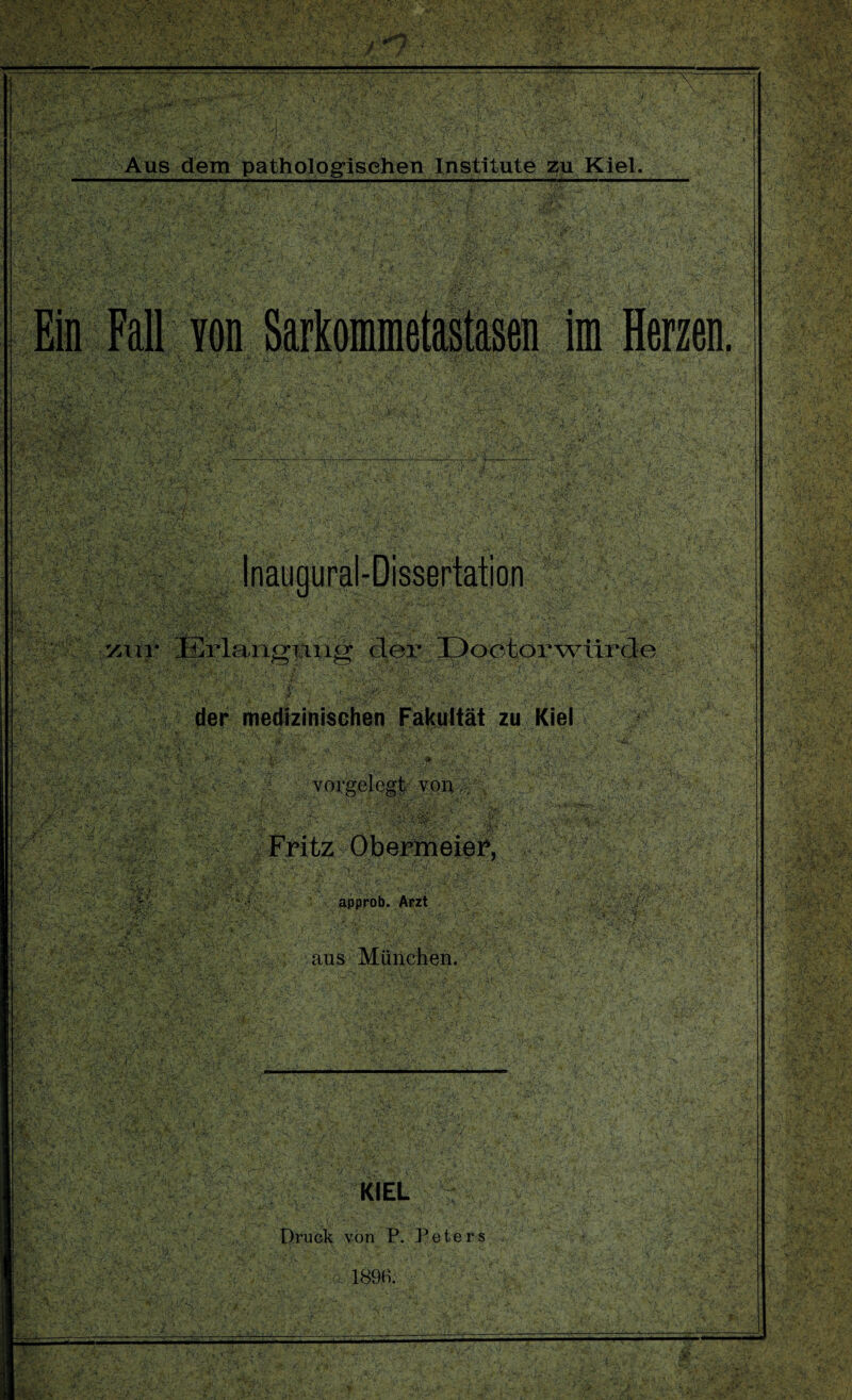 der medizinischen Fakultät zu Kiel vorgelegt von Fritz Obermeier, AVt:vA-* .••Vji' T- -r .■ ,X>7^r _ ■. approb. Arzt aus München. KIEL Druck von P. Peters