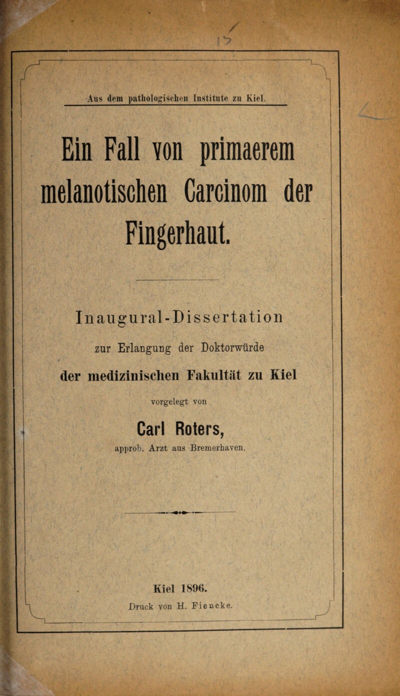 Ein Fall von primaerem melanotischen Carclnom der Fingerhaut. Inaugural-Dissertation zur Erlangung der Doktorwürde der medizinischen Fakultät zu Kiel vorgelegt von Carl Roters, approb. Arzt aus Bremerhaven. Kiel 1896. Druck von H. Fiencke.