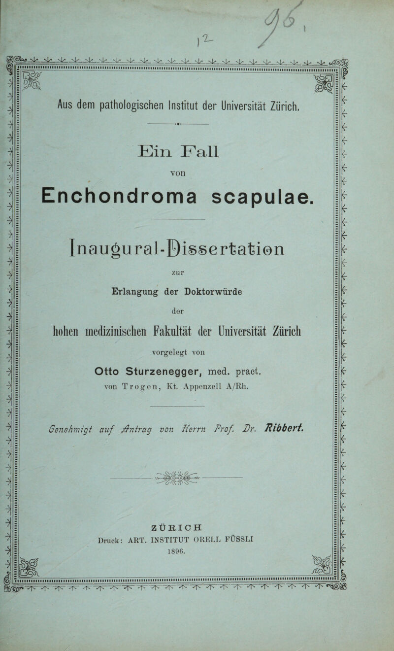 I ) ^(gUa-N^ ->.k_-^__xkL_ nU« nU nI» n!^ nU nU xU ^ ^ö)1 ft ’4^—- .iii'—i* .... -■•>■■ ,„„„„. -) fr fr A ( fr fr fr i fr fr ■7 fr fr fr fr fr frp fr| fr fr[ fr] 4 fr] 4 fr]i 7 fr fr 7 fr fr| fr| fr| fr| fr] 4 Aus dem pathologischen Institut der Universität Zürich. Ein Fall von Enchondroma scapulae. Inauöural-Bissertafcien zur Erlangung der Doktorwürde der hohen medizinischen Fakultät der Universität Zürich vorgelegt von Otto Sturzenegger, med. praet. von Trogen, Kt. Appenzell A/Rh. Genehmigt auf j&ntrag von Herrn Prof. Pr-. Jllbbert, ZÜRICH Druck: ART. INSTITUT ORELL EÜSSLI 1896. mp. X /&? -..................111,111 fr fr fr fr fr fr fr fr fr fr fr fr fr fr fr fr fr fr fr fr fr fr fr z. fr fr fr fr fr fr fr * fr fr fr fr “Tpr-Tfr Apr7 ' ✓p. '/fr“✓pr -^pr-Tpr-Tpr ^ ✓K *T- ^ -T- “T- -T* ‘T* •T-
