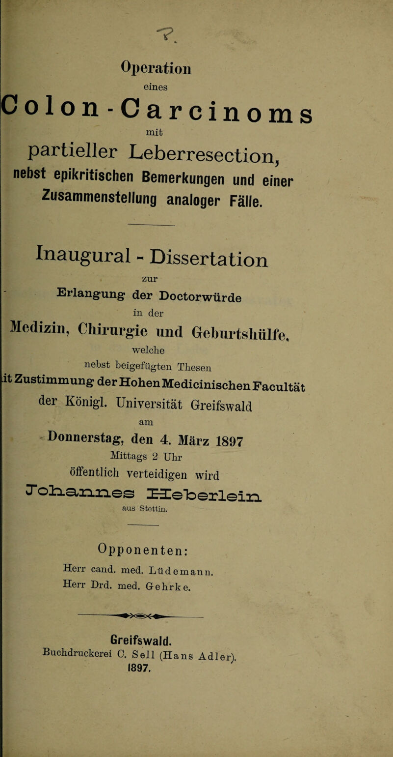 Operation eines Colon - Carcinoms mit partieller Leberresection, nebst epikritischen Bemerkungen und einer Zusammenstellung analoger Fälle. Inaugural - Dissertation zur Erlangung der Doctorwürde in der Medizin, Chirurgie und Geburtshülfe, welche nebst beigefügten Thesen it Zustimmung der Hohen Medicinischen Facultat der Königl. Universität Greifswald am Donnerstag, den 4. März 1897 Mittags 2 Uhr öffentlich verteidigen wird aus Stettin. Opponenten: Ueir cand. med. Lüde mann. Herr Drd. med. Gehrke. Greifswald. Buchdruckerei 0. Seil (Hans Adler). 1897.