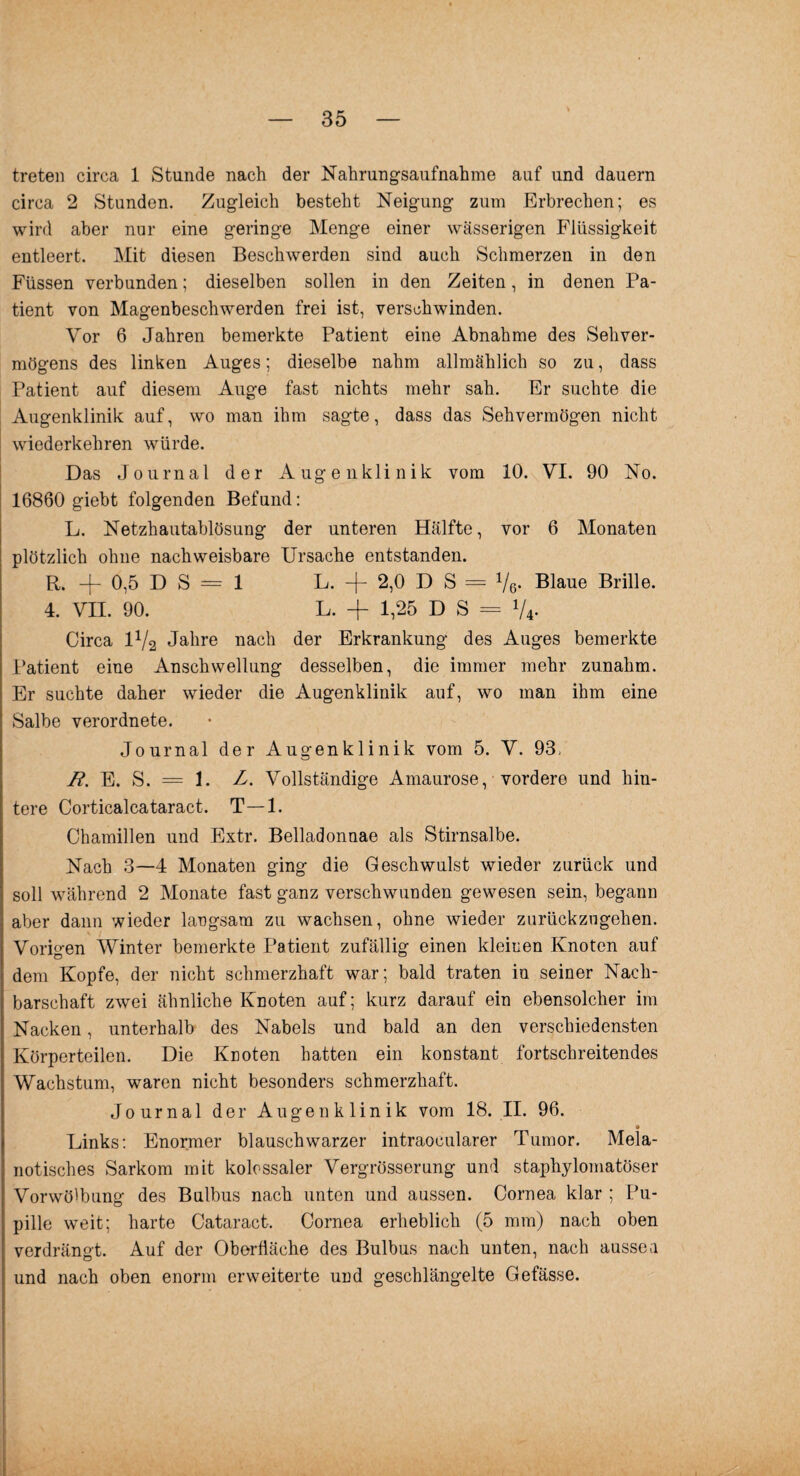 treten circa 1 Stunde nach der Nahrungsaufnahme auf und dauern circa 2 Standen. Zugleich besteht Neigung zum Erbrechen; es wird aber nur eine geringe Menge einer wässerigen Flüssigkeit entleert. Mit diesen Beschwerden sind auch Schmerzen in den Füssen verbunden; dieselben sollen in den Zeiten, in denen Pa¬ tient von Magenbeschwerden frei ist, verschwinden. Vor 6 Jahren bemerkte Patient eine Abnahme des Sehver¬ mögens des linken Auges; dieselbe nahm allmählich so zu, dass Patient auf diesem Auge fast nichts mehr sah. Er suchte die Augenklinik auf, wo man ihm sagte, dass das Sehvermögen nicht wiederkehren würde. Das Journal der Augenklinik vom 10. VI. 90 No. 16860 giebt folgenden Befund: L. Netzhautablösung der unteren Hälfte, vor 6 Monaten plötzlich ohne nachweisbare Ursache entstanden. R. -f 0,5 D S = 1 L. -f- 2,0 D S = V6. Blaue Brille. 4. VII. 90. L. + 1,25 DS = V4. Circa 11/2 Jahre nach der Erkrankung des Auges bemerkte Patient eine Anschwellung desselben, die immer mehr zunahm. Er suchte daher wieder die Augenklinik auf, wo man ihm eine Salbe verordnete. Journal der Augenklinik vom 5. V. 93, B. E. S. = 1. L. Vollständige Amaurose, vordere und hin¬ tere Corticalcataract. T—1. Chamillen und Extr. Belladonnae als Stirnsalbe. Nach 3—4 Monaten ging die Geschwulst wieder zurück und soll während 2 Monate fast ganz verschwunden gewesen sein, begann aber dann wieder langsam zu wachsen, ohne wieder zurückzugehen. Vorigen Winter bemerkte Patient zufällig einen kleinen Knoten auf dem Kopfe, der nicht schmerzhaft war; bald traten in seiner Nach¬ barschaft zwei ähnliche Knoten auf; kurz darauf ein ebensolcher im Nacken, unterhalb des Nabels und bald an den verschiedensten Körperteilen. Die Knoten hatten ein konstant fortschreitendes Wachstum, waren nicht besonders schmerzhaft. Journal der Augenklinik vom 18. II. 96. Links: Enormer blauschwarzer intraocularer Tumor. Mela- notisches Sarkom mit kolossaler Vergrösserung und staphylomatöser Vorwölbung des Bulbus nach unten und aussen. Cornea klar ; Pu¬ pille weit; harte Cataract. Cornea erheblich (5 mm) nach oben verdrängt. Auf der Oberfläche des Bulbus nach unten, nach aussen und nach oben enorm erweiterte und geschlängelte Gefässe.