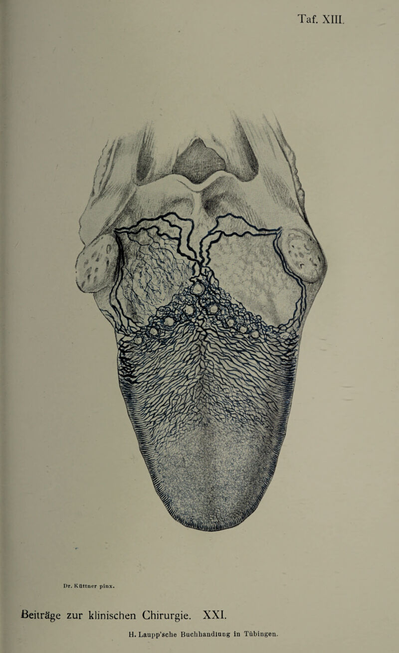Dr. KUttner pinx. Beitrage zur klinischen Chirurgie. XXI.