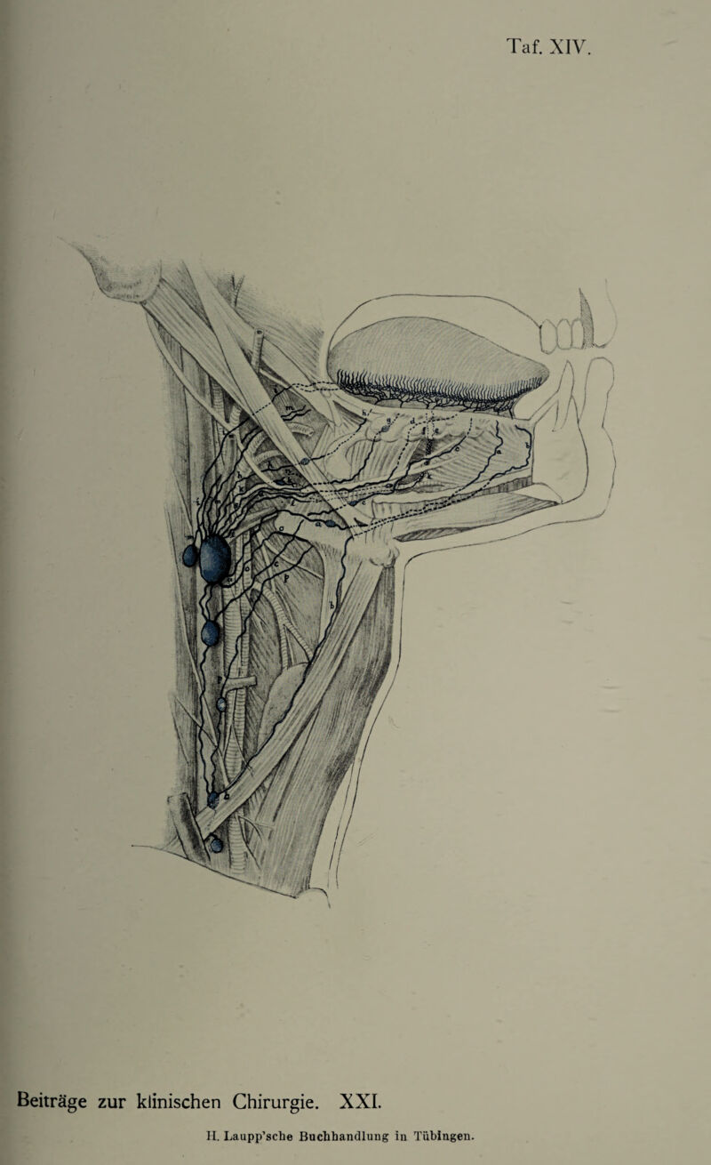 Taf. XIV. Beitrage zur klinischen Chirurgie. XXI.