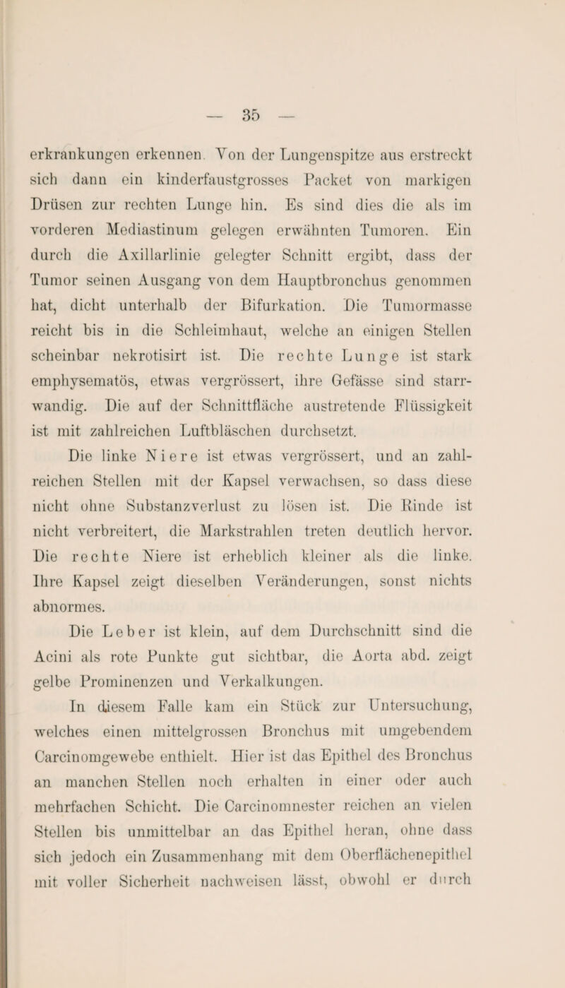 erkrankungen erkennen. Yon der Lungenspitze aus erstreckt sich dann ein kinderfaustgrosses Packet von markigen Drüsen zur rechten Lunge hin. Es sind dies die als im vorderen Mediastinum gelegen erwähnten Tumoren. Ein durch die Axillarlinie gelegter Schnitt ergibt, dass der Tumor seinen Ausgang von dem Hauptbronchus genommen hat, dicht unterhalb der Bifurkation. Die Tumormasse reicht bis in die Schleimhaut, welche an einigen Stellen scheinbar nekrotisirt ist. Die rechte Lunge ist stark emphysematos, etwas vergrössert, ihre Gefässe sind starr- wandig. Die auf der Schnittfläche austretende Flüssigkeit ist mit zahlreichen Luftbläschen durchsetzt. Die linke Niere ist etwas vergrössert, und an zahl¬ reichen Stellen mit der Kapsel verwachsen, so dass diese nicht ohne Substanzverlust zu lösen ist. Die Rinde ist nicht verbreitert, die Markstrahlen treten deutlich hervor. Die rechte Niere ist erheblich kleiner als die linke. Ihre Kapsel zeigt dieselben Veränderungen, sonst nichts abnormes. Die Leber ist klein, auf dem Durchschnitt sind die Acini als rote Punkte gut sichtbar, die Aorta abd. zeigt gelbe Prominenzen und Verkalkungen. In diesem Falle kam ein Stück zur Untersuchung, welches einen mittelgrossen Bronchus mit umgebendem Carcinomgewebe enthielt. Hier ist das Epithel des Bronchus an manchen Stellen noch erhalten in einer oder auch mehrfachen Schicht. Die Carcinomnester reichen an vielen Stellen bis unmittelbar an das Epithel heran, ohne dass sich jedoch ein Zusammenhang mit dem Oberflächenepithel mit voller Sicherheit nachweisen lässt, obwohl er durch